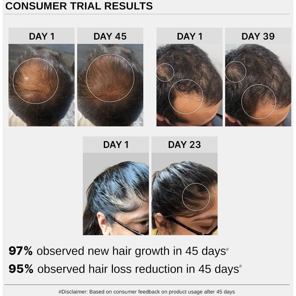 Suero Crecimiento Cabello Bare Anatomy 30mL - Redensyl 3%