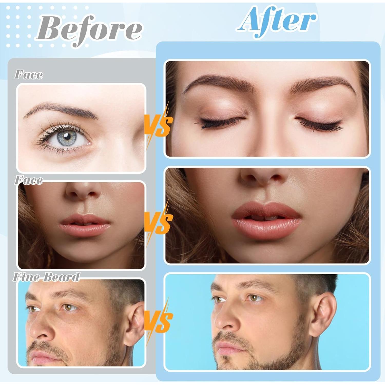 Rasuradora Dermaplane ProSuites 16 Piezas para Mujeres