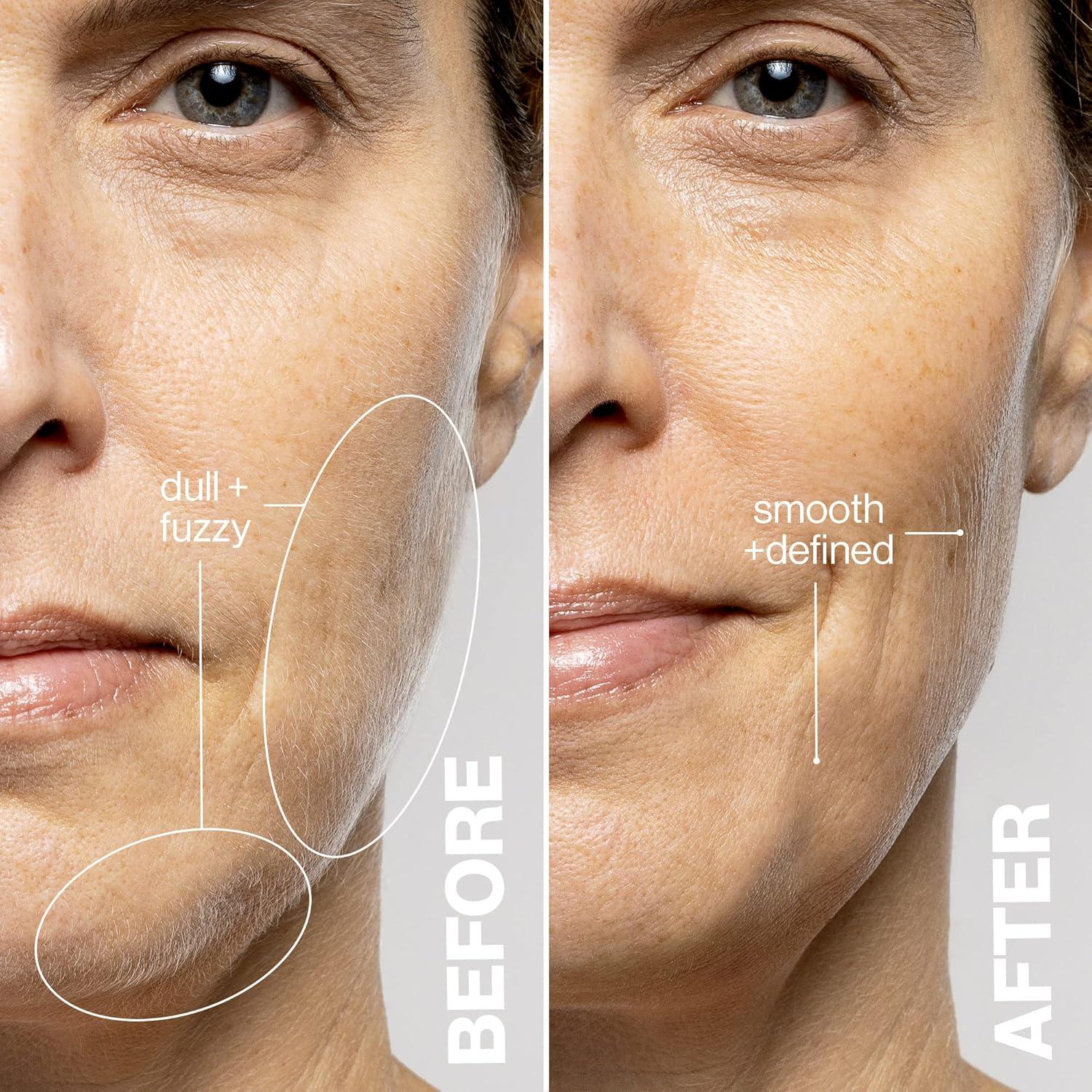 DERMAFLASH LUXE+ Exfoliador Facial Sónico 2 en 1 348g