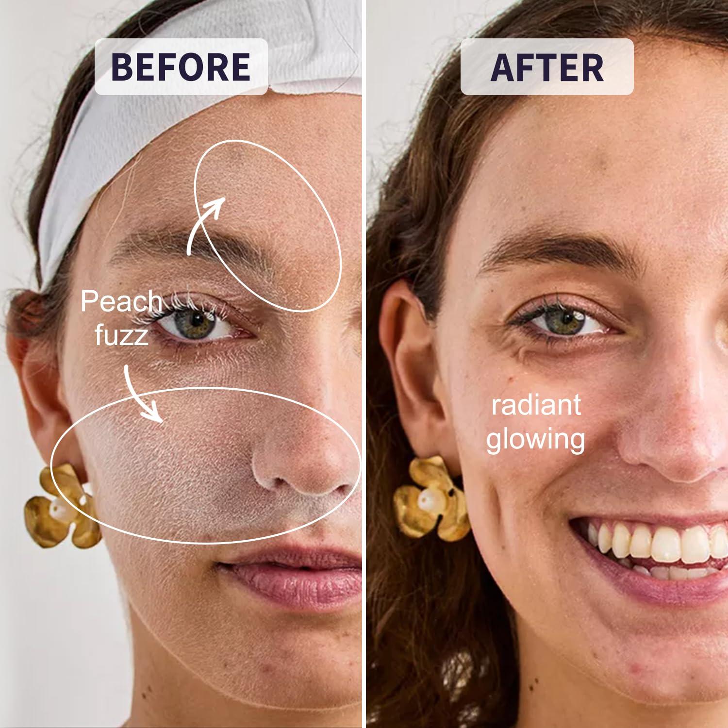 Rasuradora Facial THURLADY Escarcha Egea con 19 Cuchillas