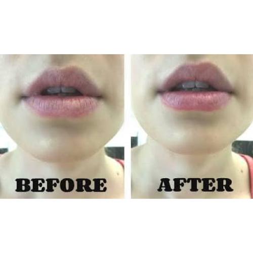 Set de Cuidado Labial 2-en-1 Dalya - Exfoliante y Mascarilla