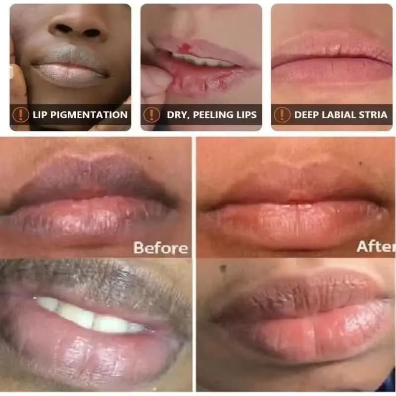 Bálsamo Labial Natural LCRORO 2PCS Hidratante Amarillo