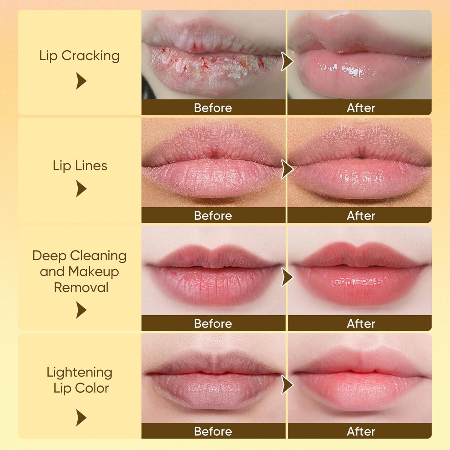 Suero Labial y Mascarilla Espumosa Misoour - 3 Piezas 4.1 ml