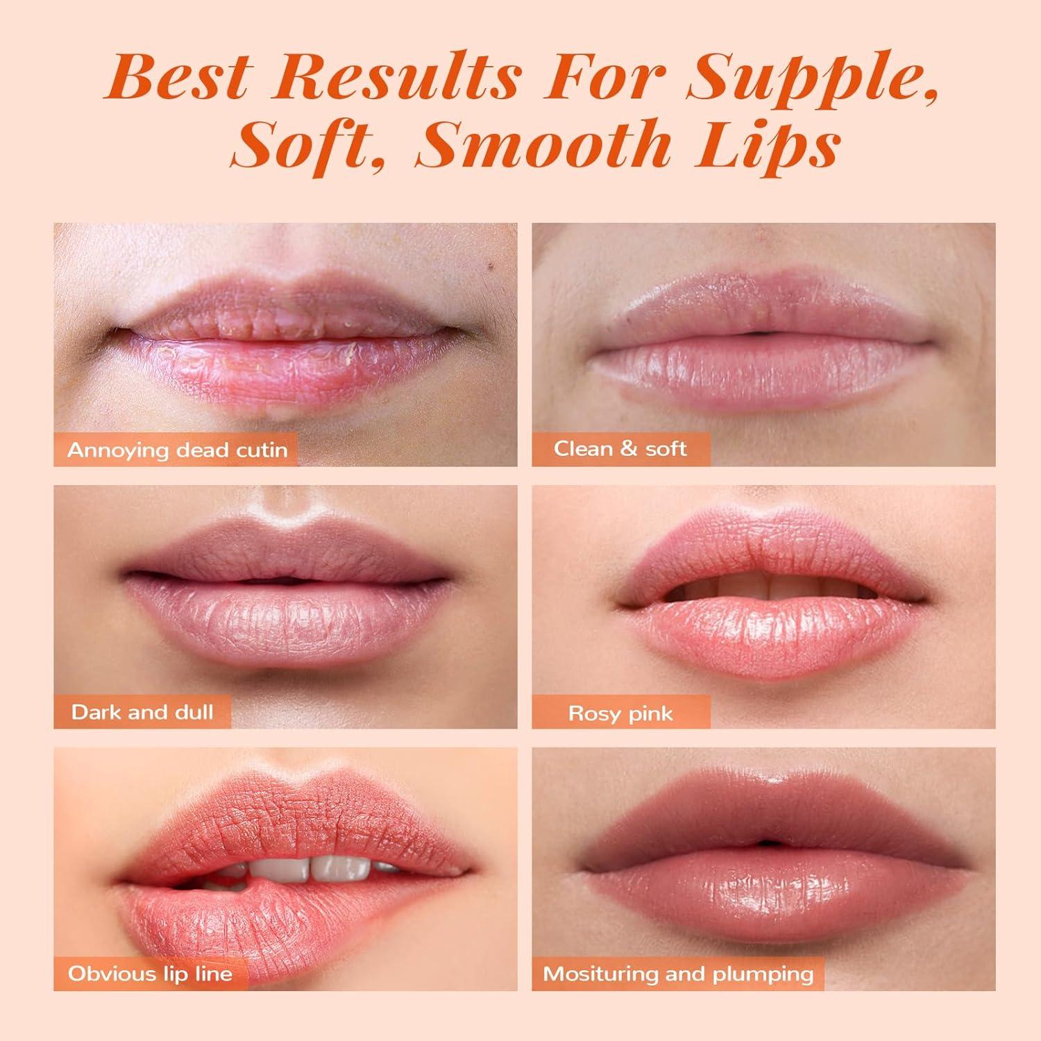 Conjunto de Cuidado de Labios ANAI RUI - Exfoliante y Balsamo