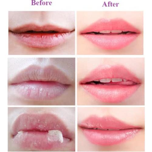 Mascarilla Hidratante para Labios Krajiyya 2PCS Miel y Fresa