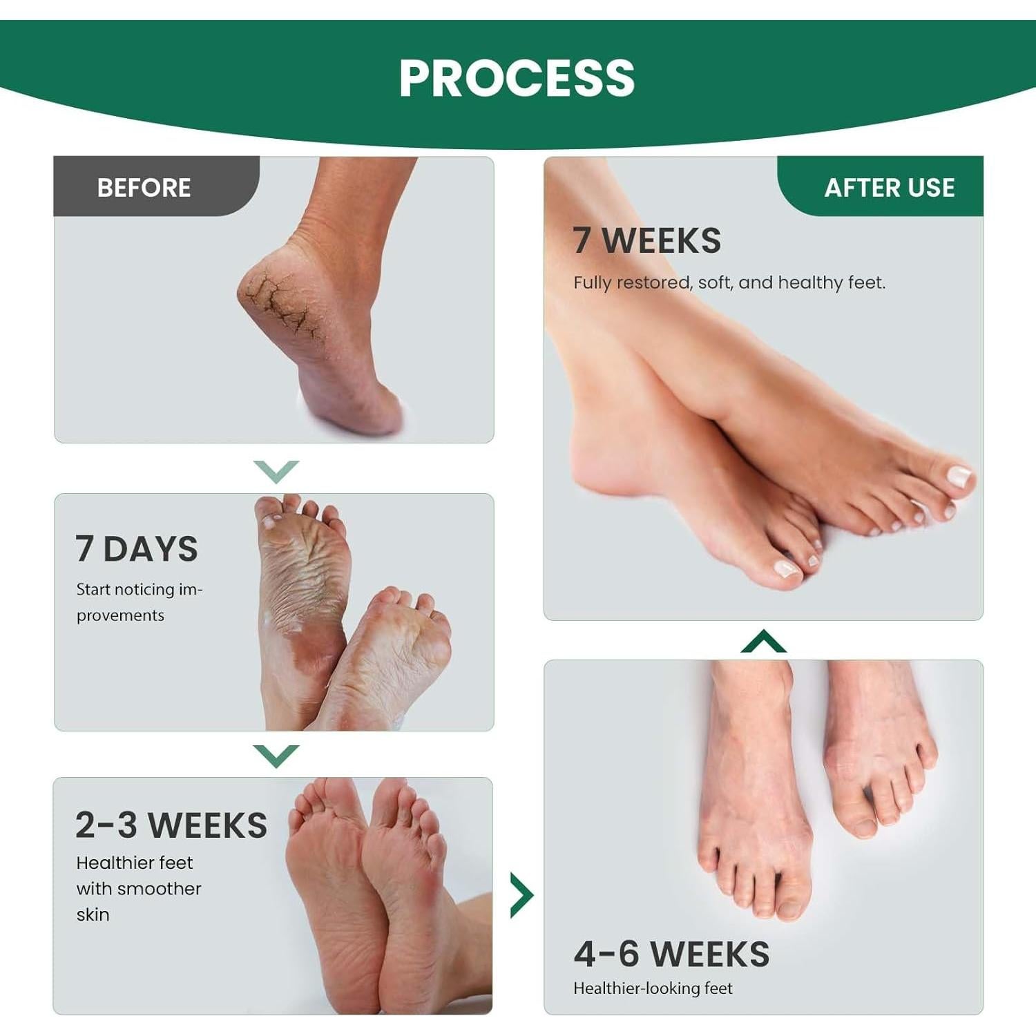 Spray para Pies AIFUFAND de Jengibre 20ml - Cuidado Natural