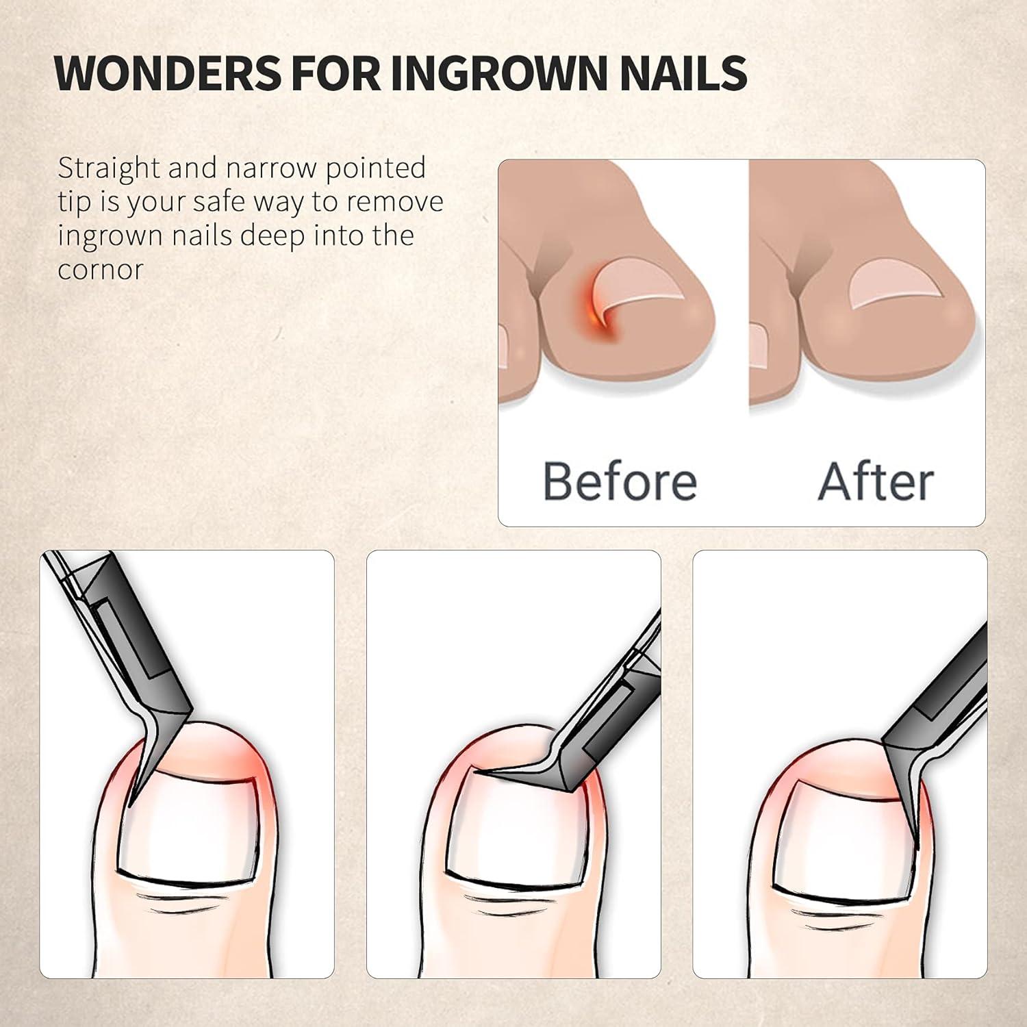 Cortador de Uñas de Pies FERYES Acero Inoxidable 10.19cm