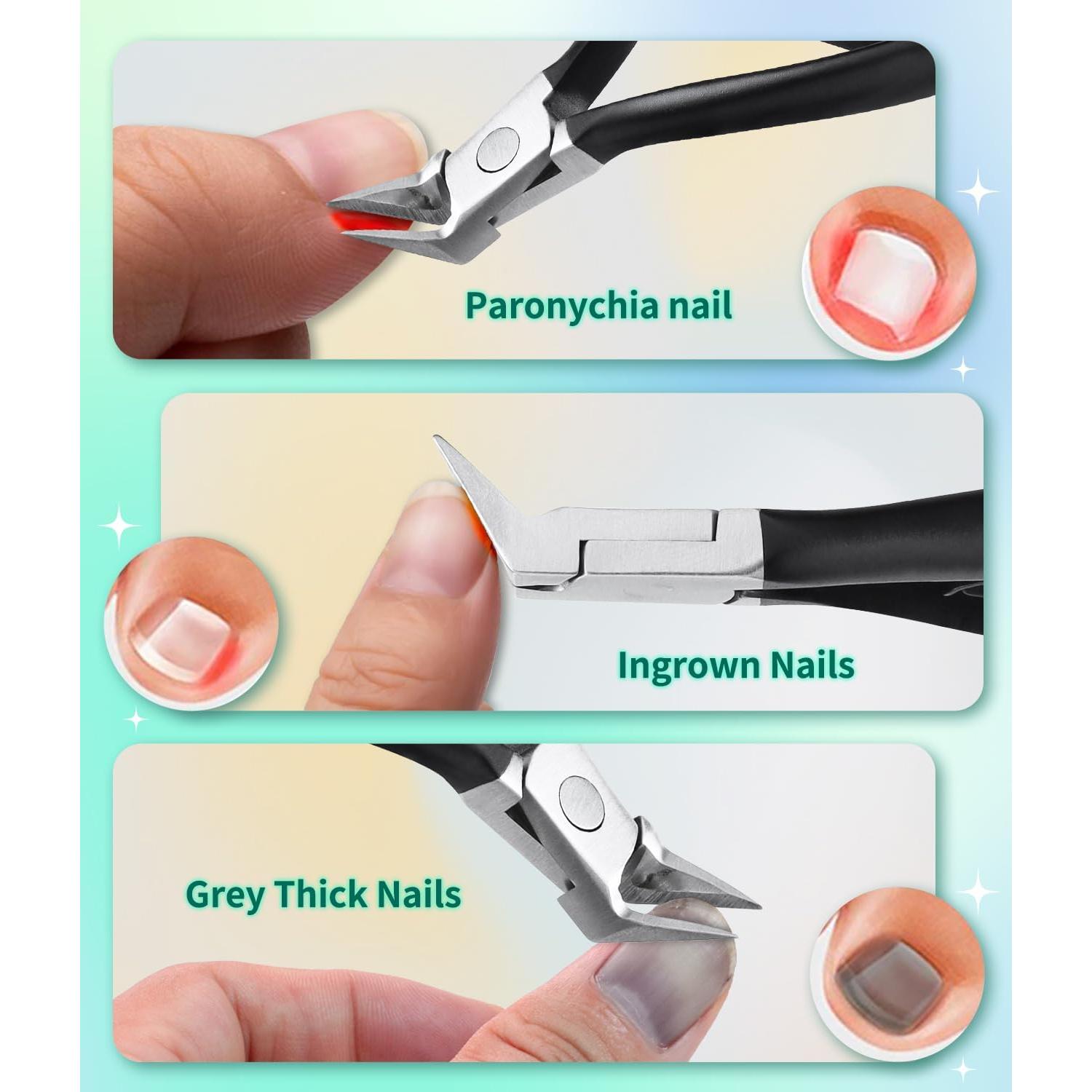 Cortador de Uñas Encarnadas ILLFER Acero Inoxidable 12 cm