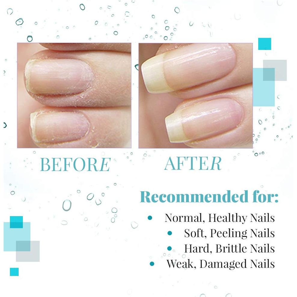 Aceite para Cutículas Nail Tek Renew 13.6 ml - Hidratante Natural