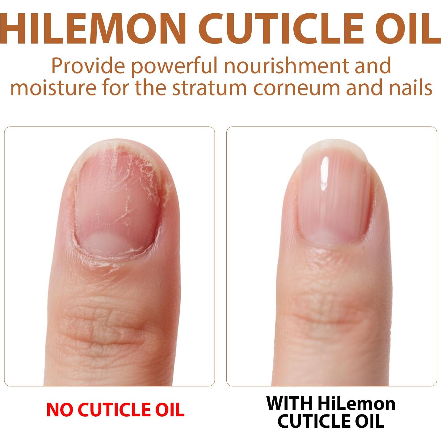 Aceite Natural para Cutículas HiLemon 8 ml Hidratante con Vitamina E
