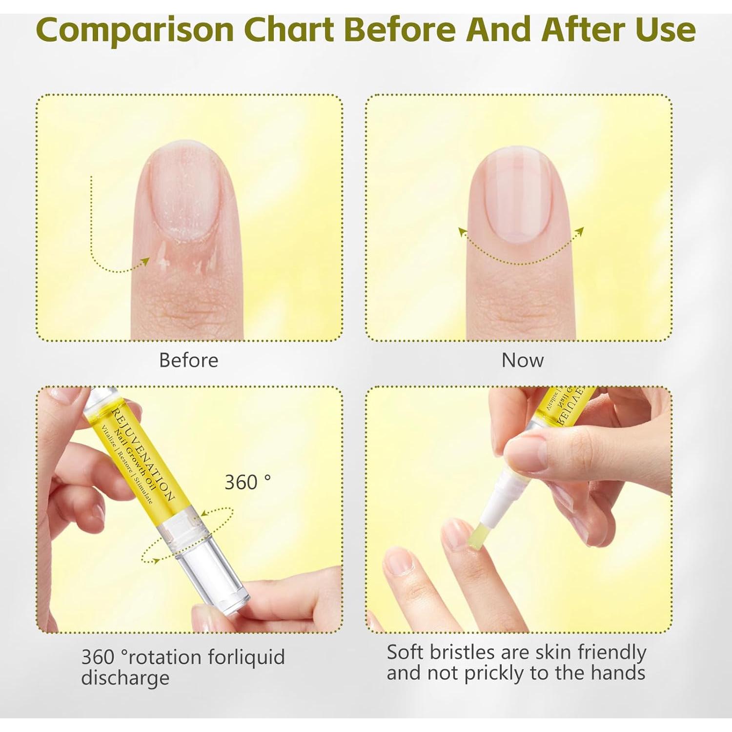 Aceite Rejuvenecedor para Uñas Tbexem - Crecimiento y Protección