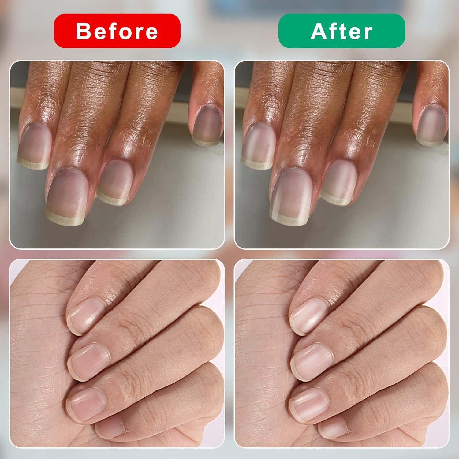 Kit de Pulido y Brillo de Uñas CGBE - 1000/4000 Grano Verde