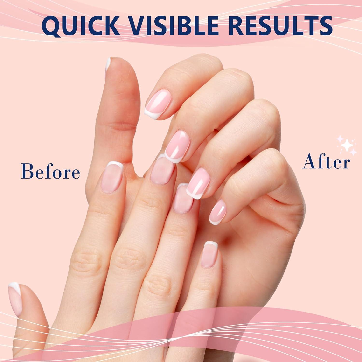 Kit de Bloques Pulidores de Uñas SALVMARY - 4 Piezas Todo en Uno