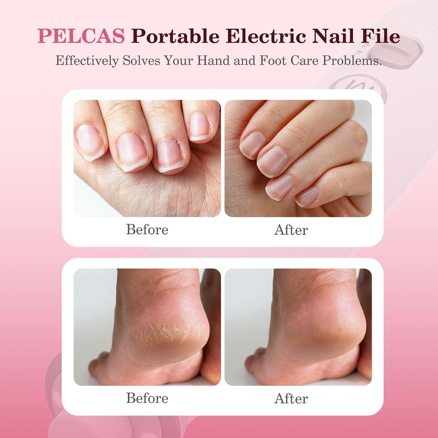 Lima de Uñas Eléctrica PELCAS Inalámbrica 10 Velocidades LED