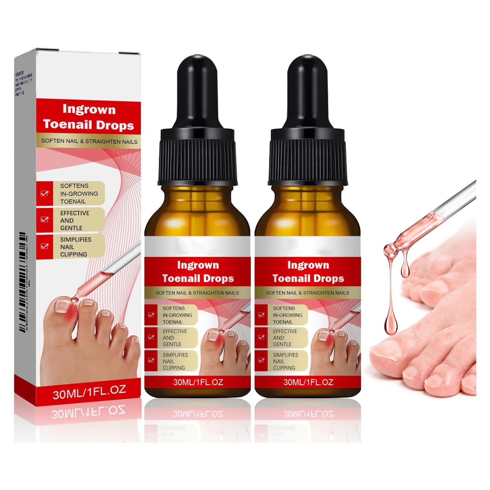 Kit 2 gotas para uñas encarnadas AUJ 10ml - Alivio y suavización