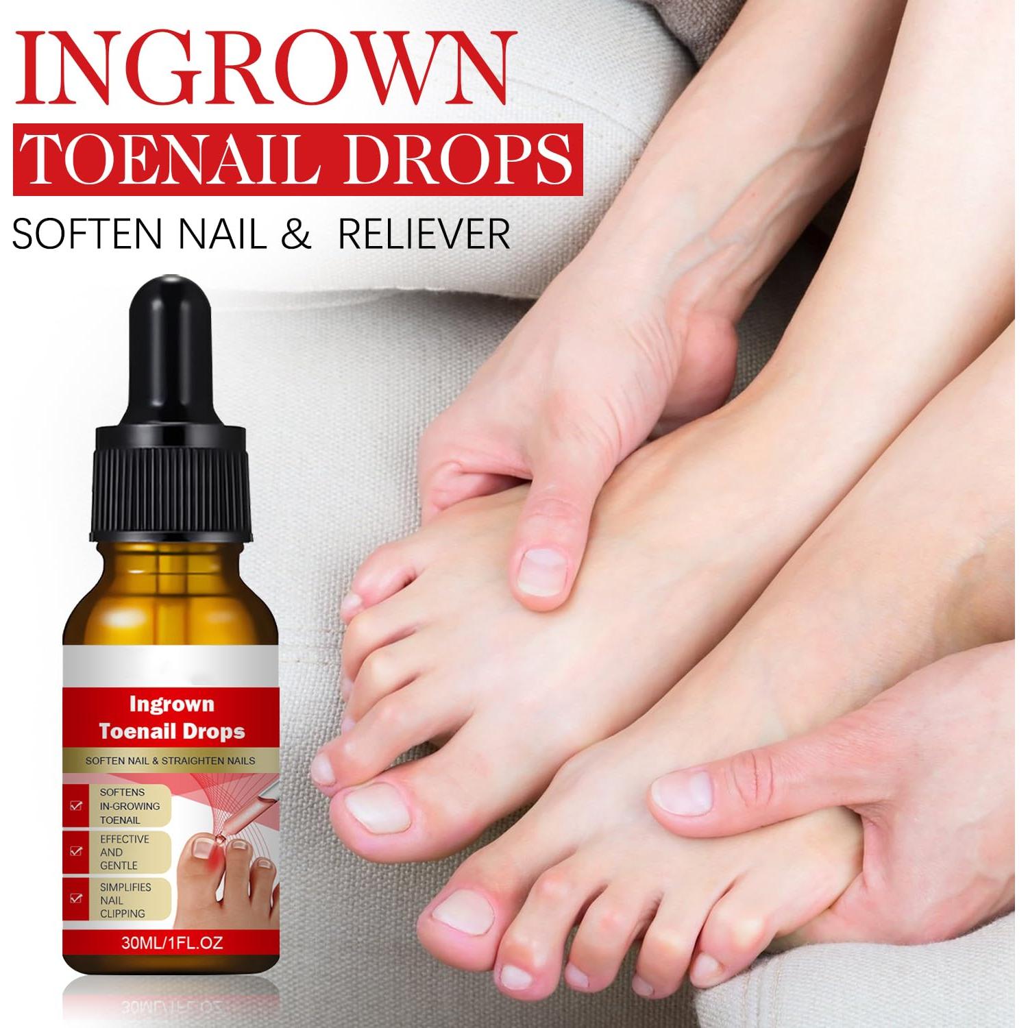 Kit 2 gotas para uñas encarnadas AUJ 10ml - Alivio y suavización