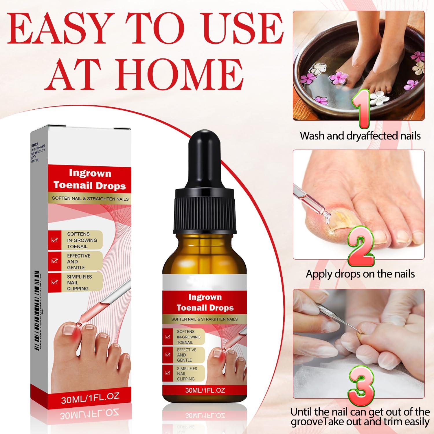 Kit 2 gotas para uñas encarnadas AUJ 10ml - Alivio y suavización