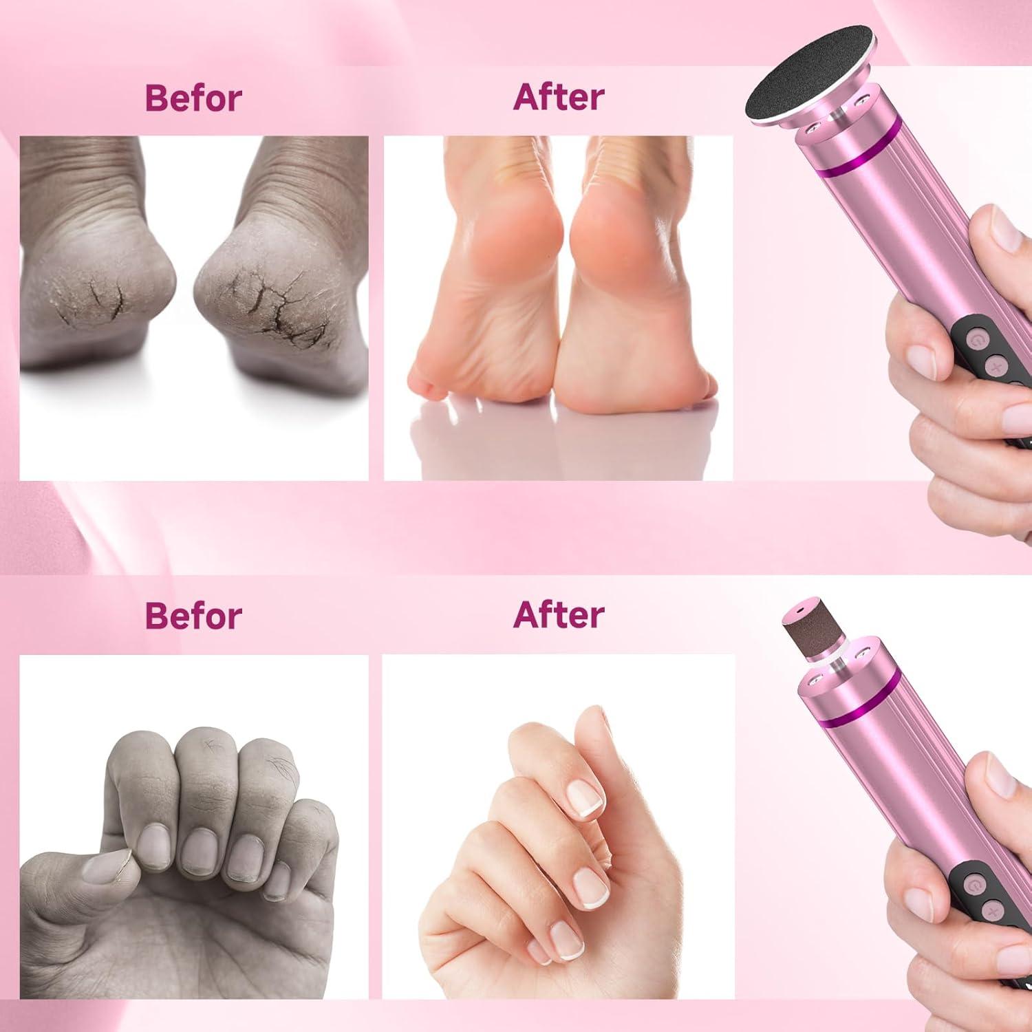 Lima Eléctrica Inalámbrica Dermave 2 en 1 para Pies y Uñas