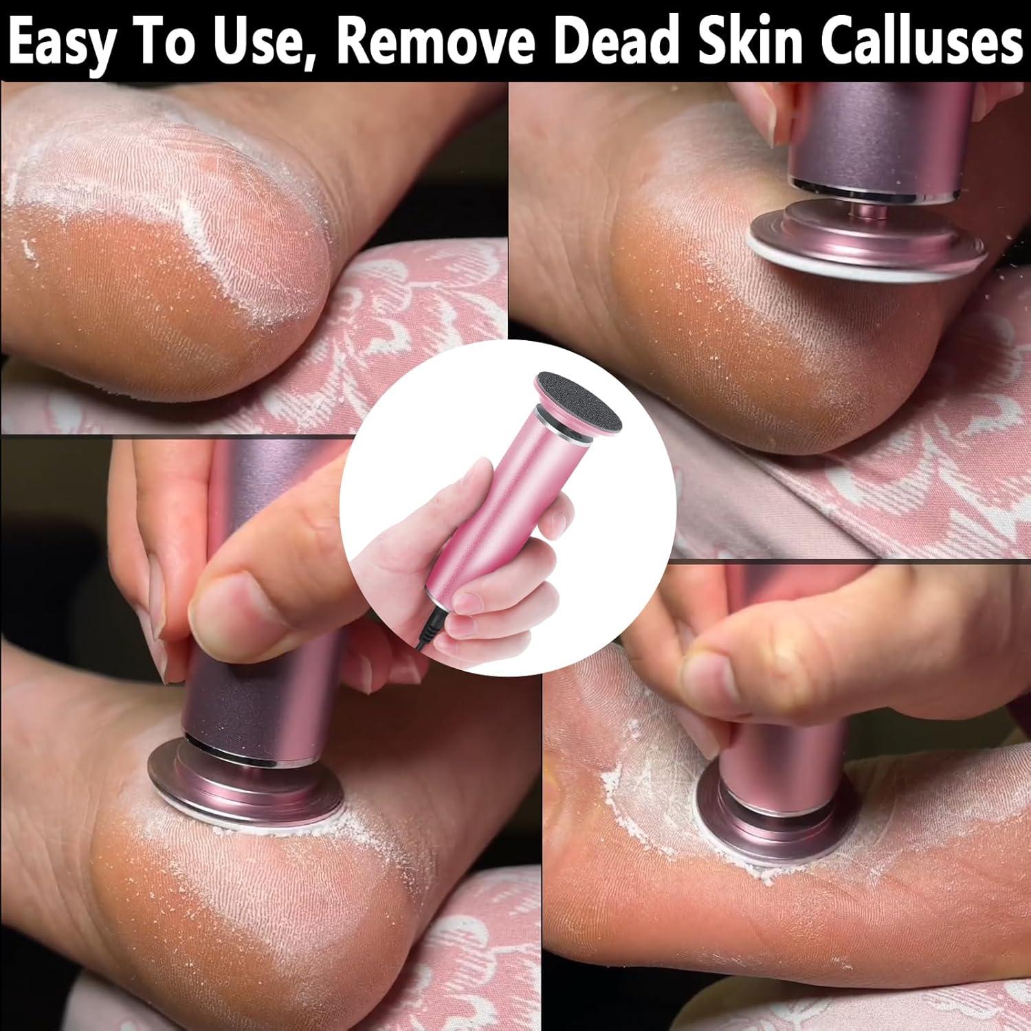 Removedor de Callos Eléctrico I.B.N FCR-1 Rosa Ajustable