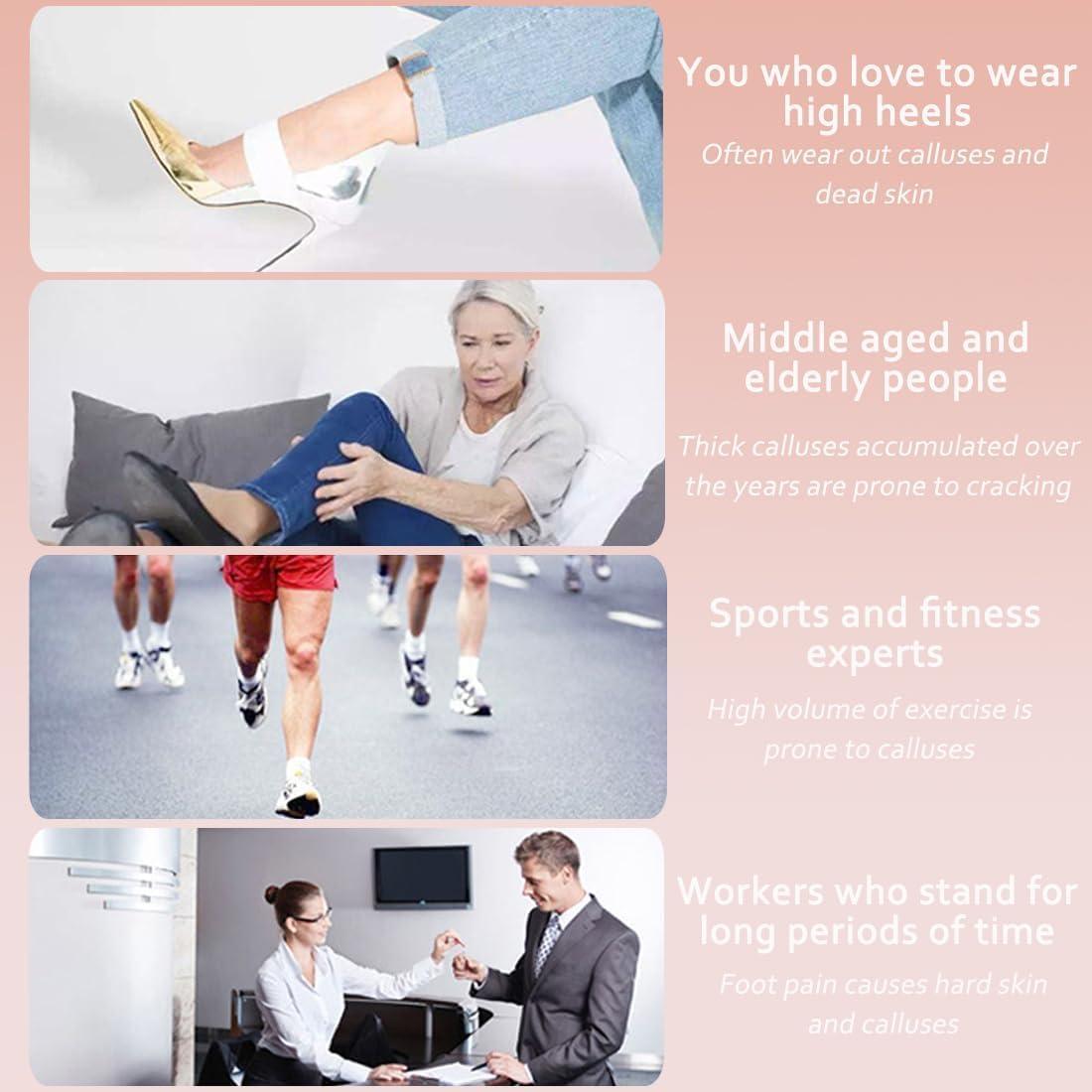 Removedor de Callos Eléctrico Dermave Rosa con 60 Discos