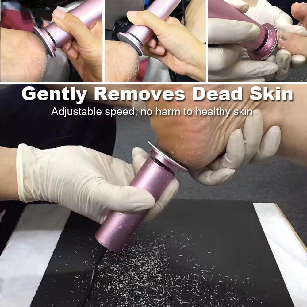 Removedor de Callos Eléctrico I.B.N Rosa con 60 Discos Lijadores