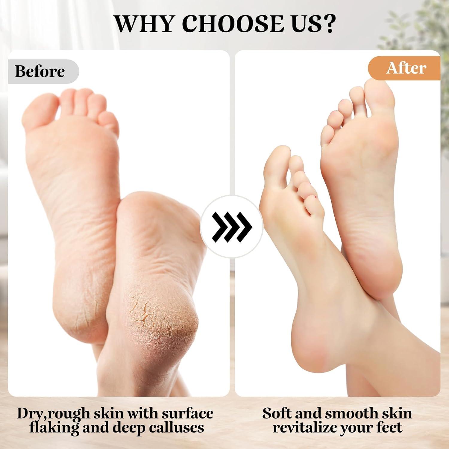 Removedor de Callos Eléctrico Nuaoi con 3 Cabezas y 2 Velocidades