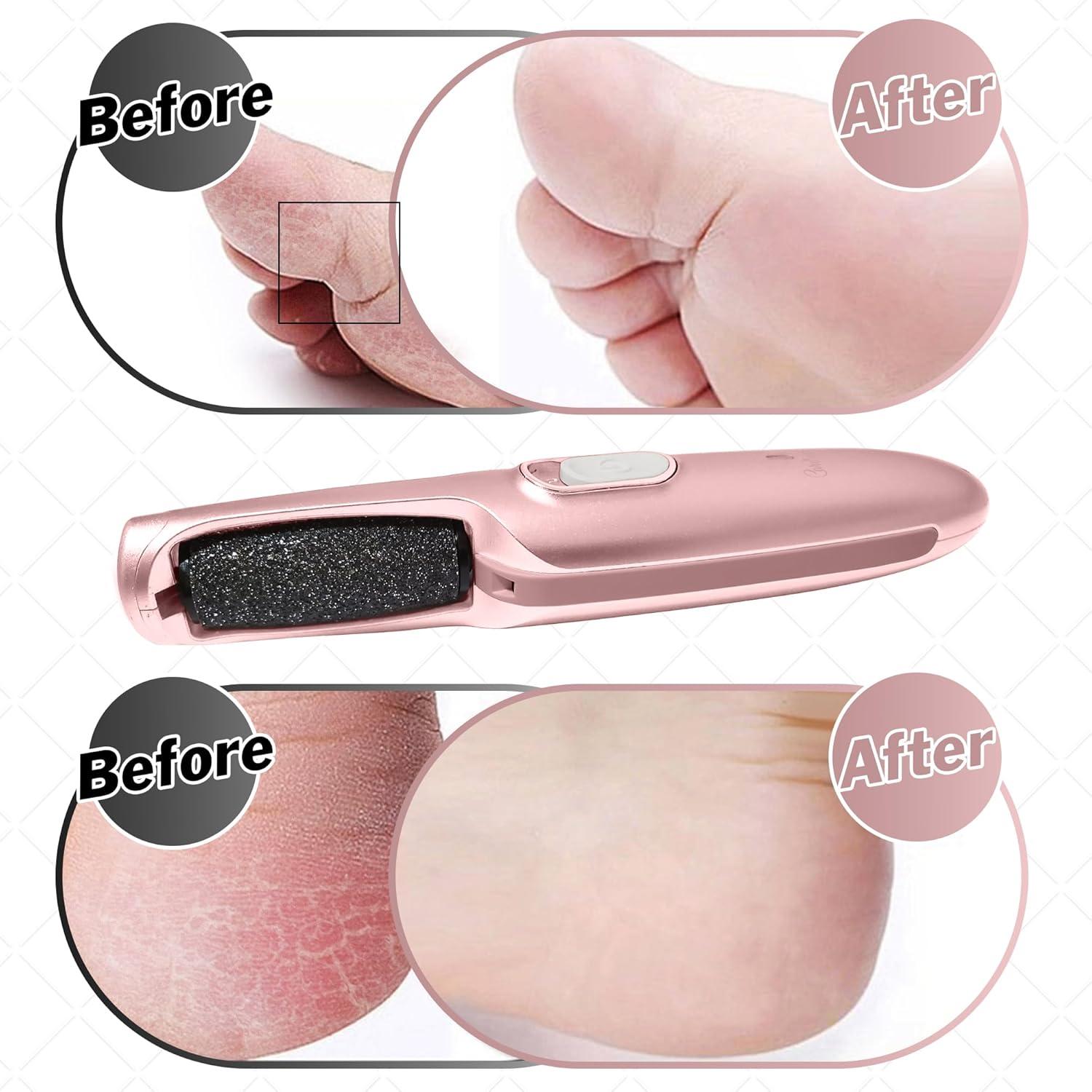 Removedor de Callos Eléctrico Cuídame PL22 - Lima Recargable Oro Rosa