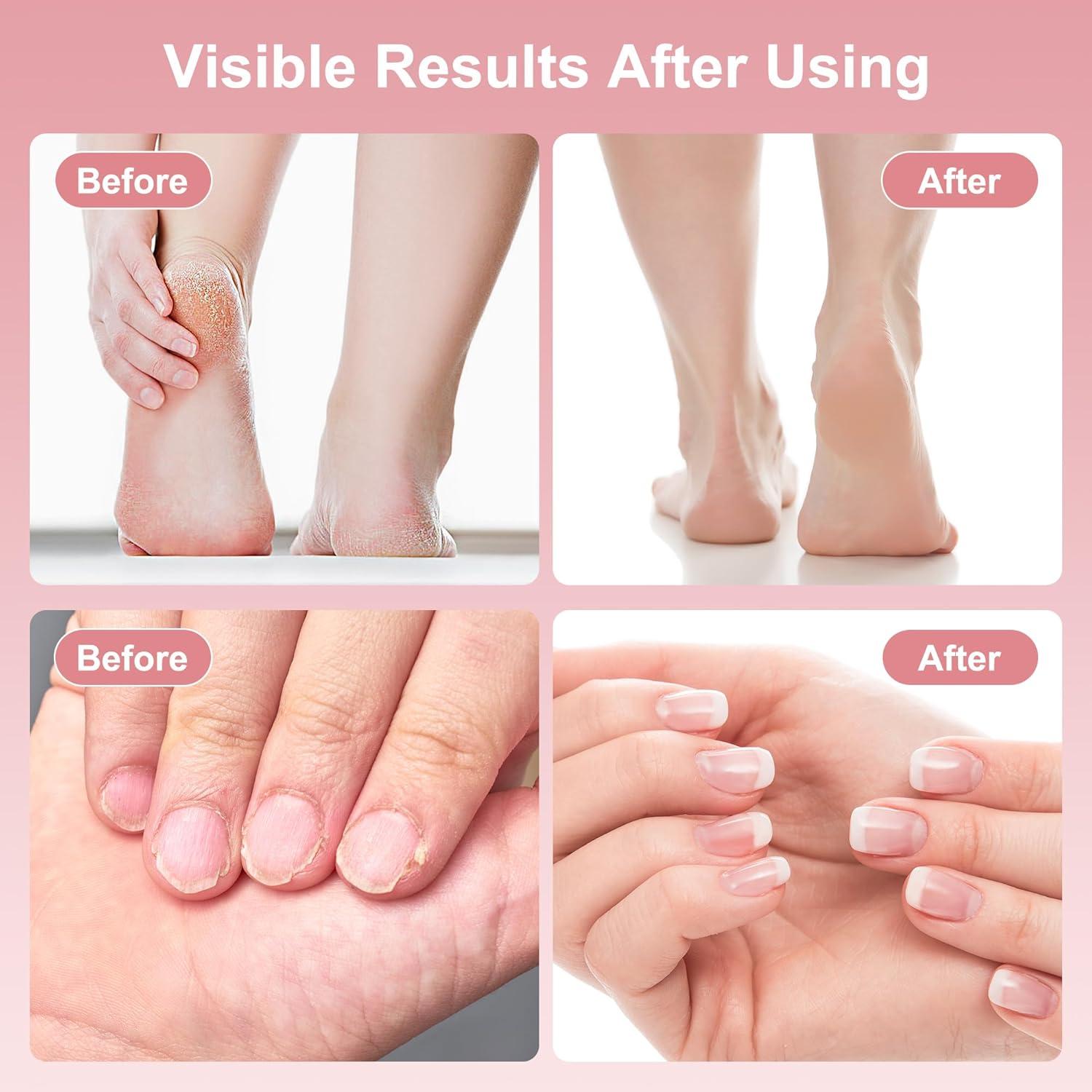 Removedor de Callos Eléctrico ERROWIN 2 en 1 Rosa 9 Velocidades