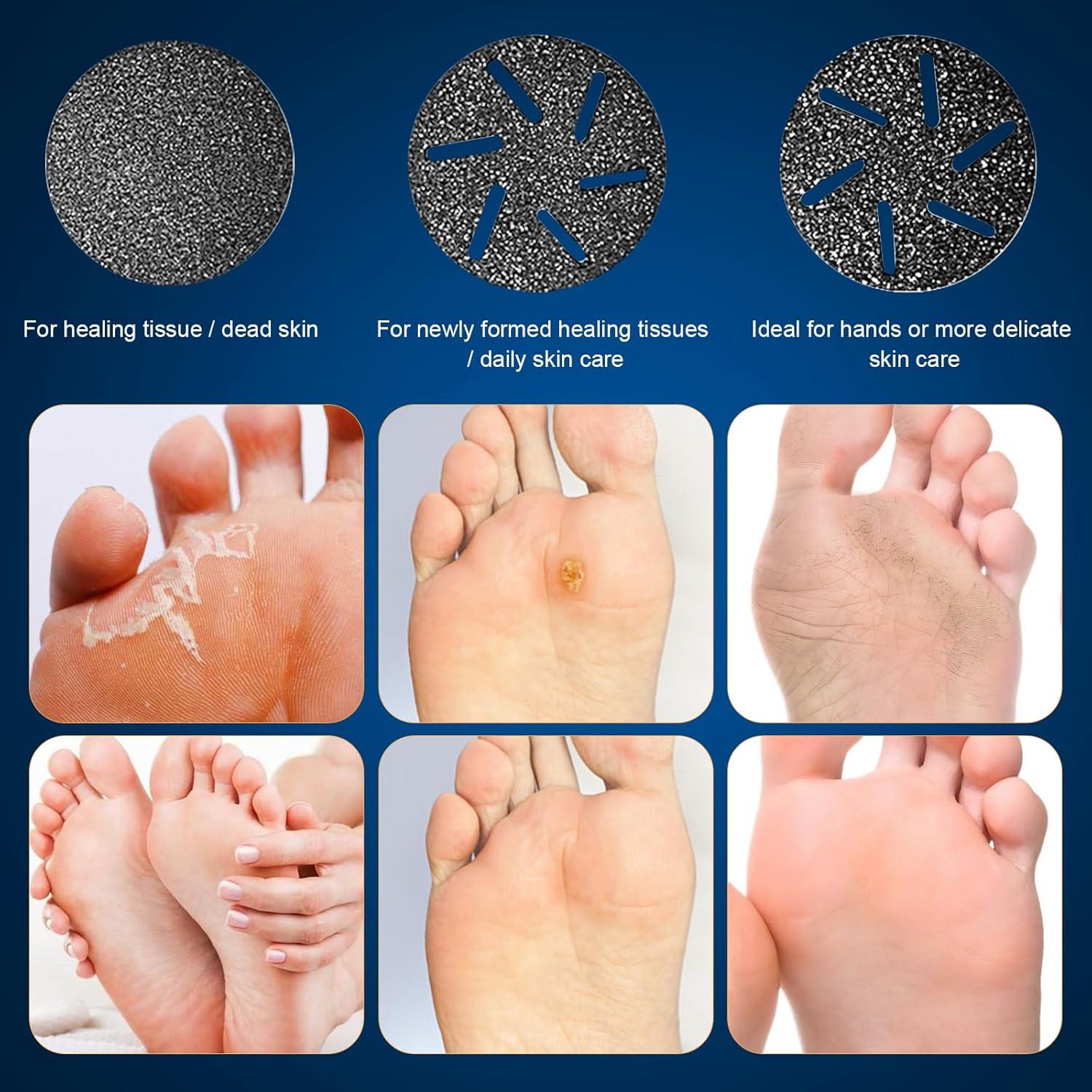 Removedor de Callos Eléctrico RIRC con Pantalla LCD y 2 Velocidades