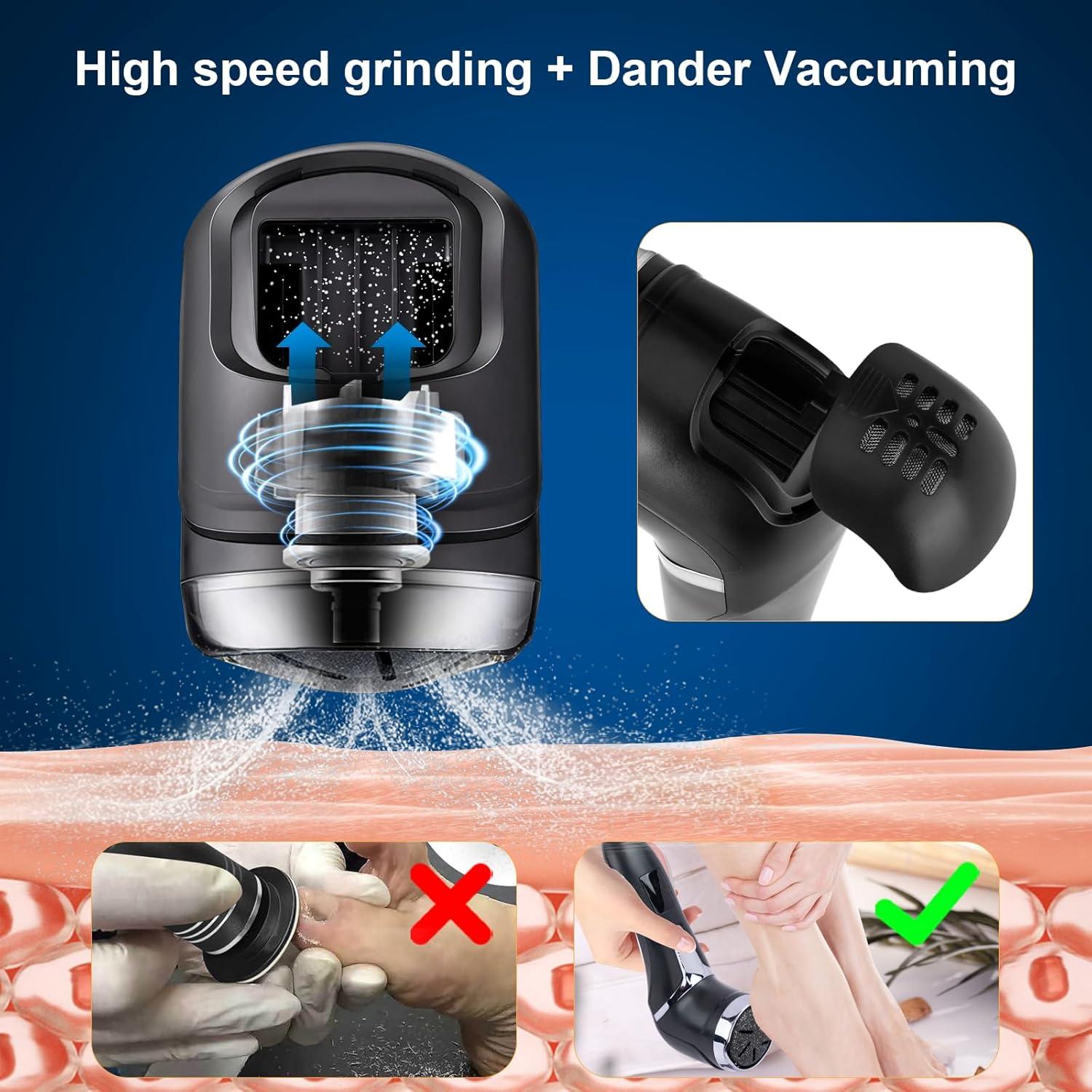 Removedor de Callos Eléctrico RIRC con Pantalla LCD y 2 Velocidades