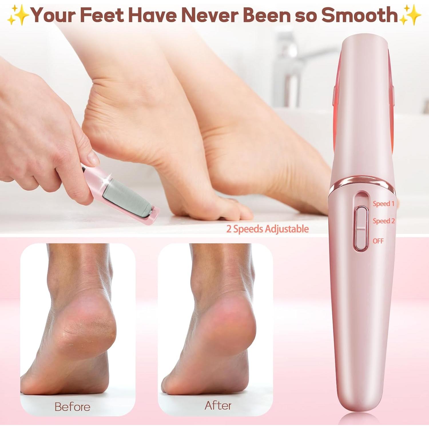 Removedor de Callos Eléctrico ZABOUL Varita de Pedicura Rosa