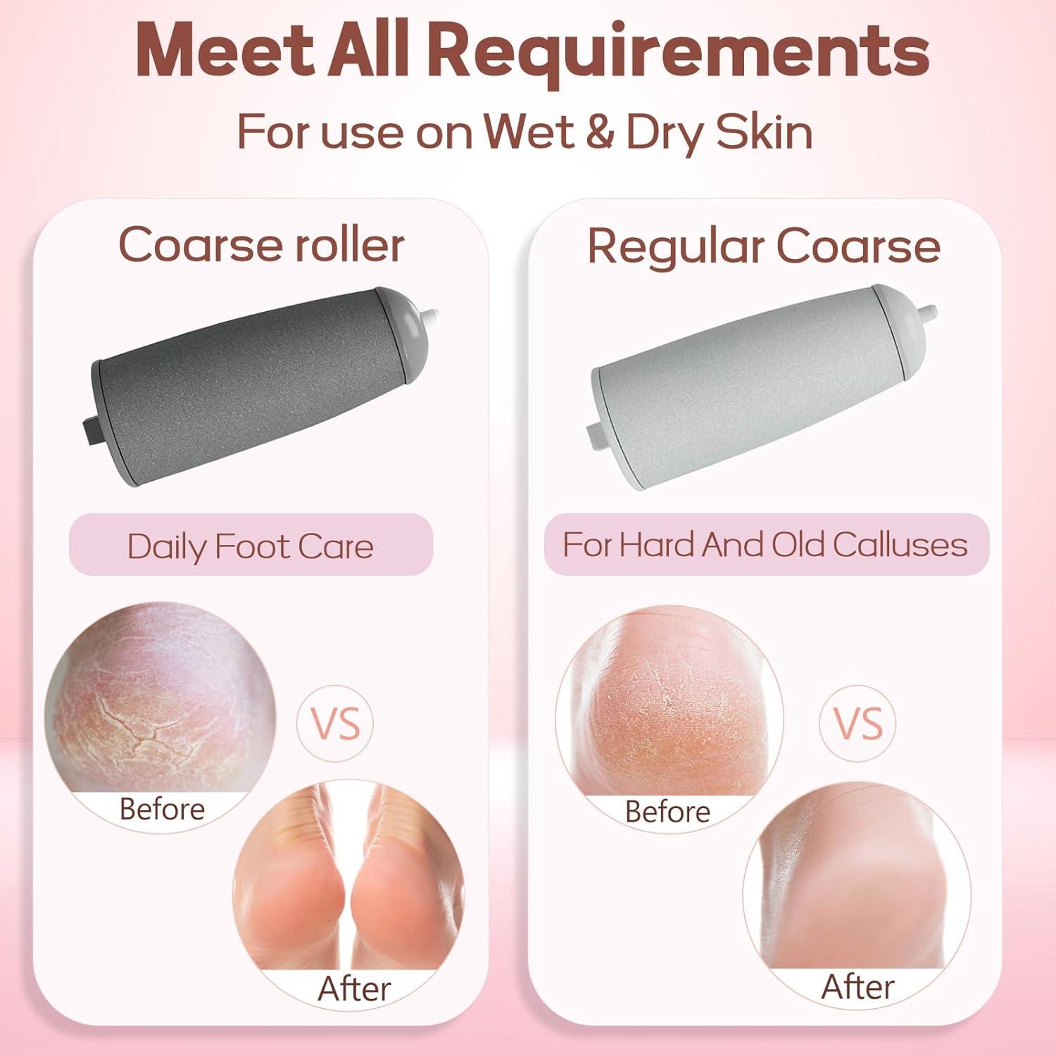 Removedor de Callos Eléctrico ZABOUL Varita de Pedicura Rosa