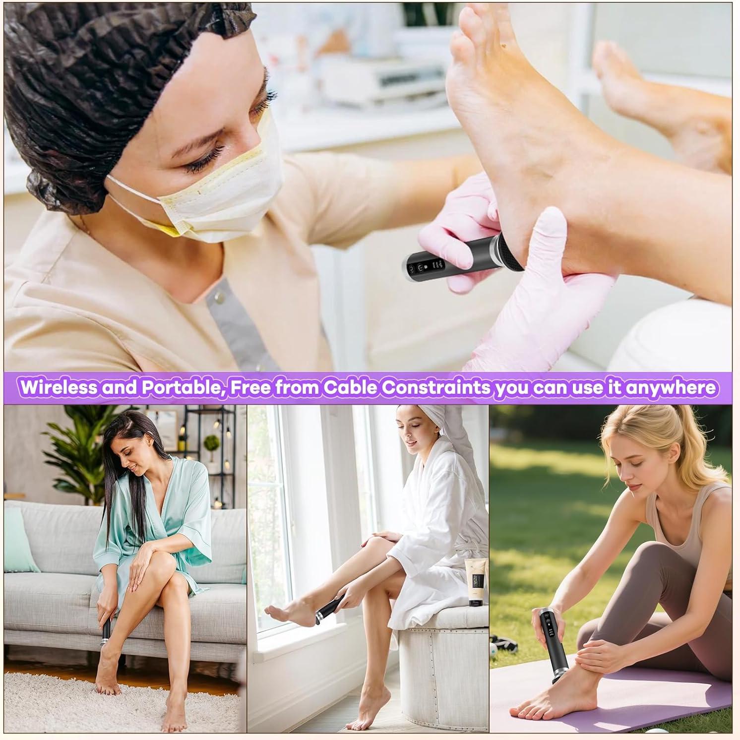 Removedor de Callos Eléctrico CYFERUY con Cabezal de Nano Vidrio