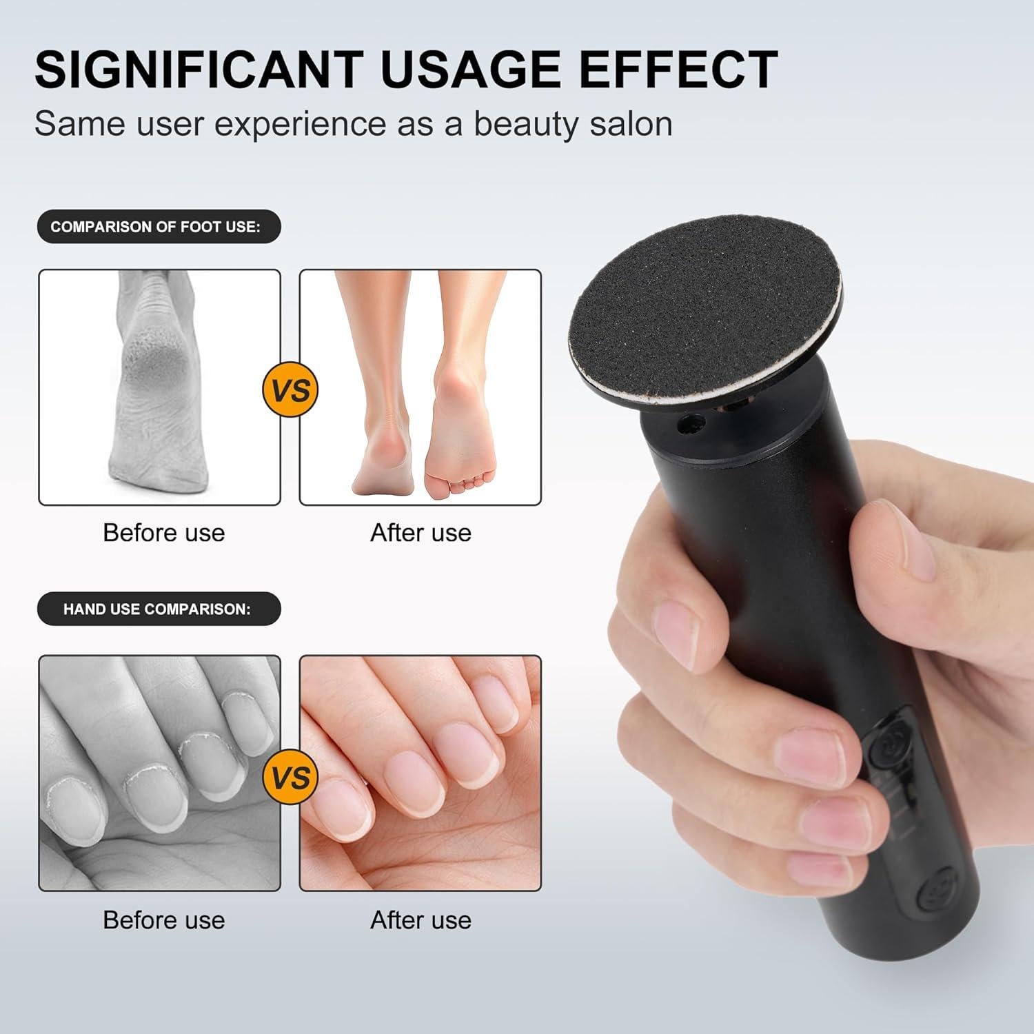 Removedor de Callos Eléctrico Cesekao Obsidiana 9 Velocidades