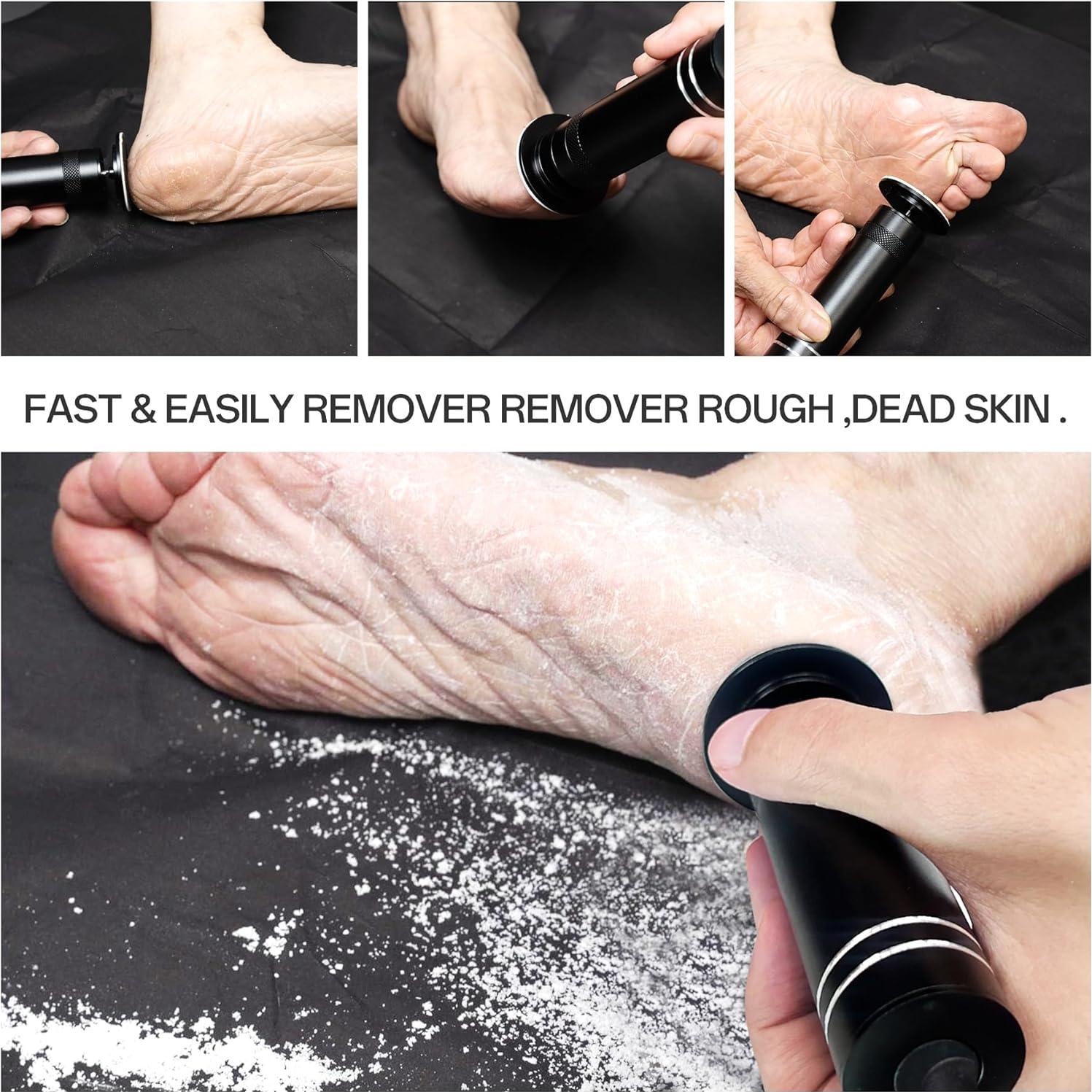 Removedor de Callos Eléctrico Niomuis con 60 Discos - Negro