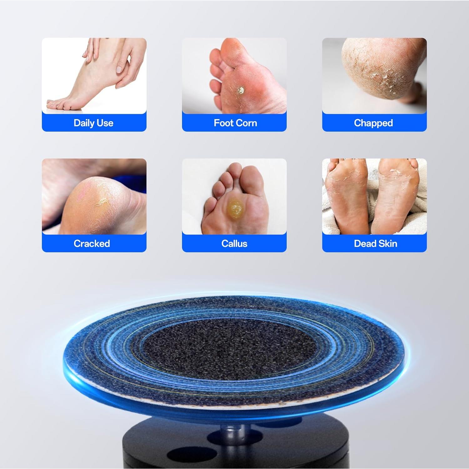 Removedor de Callos Eléctrico Niomuis con 60 Discos - Negro