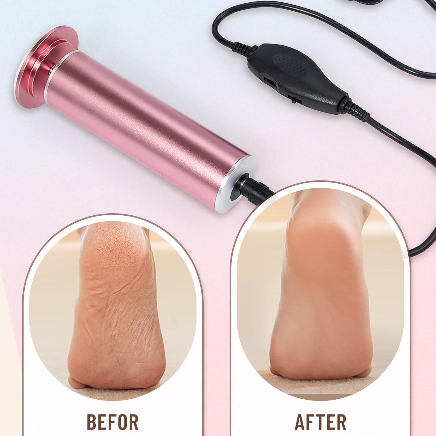 Dermawave Eliminador de Callos Eléctrico UNIBOUTI con 60 Discos