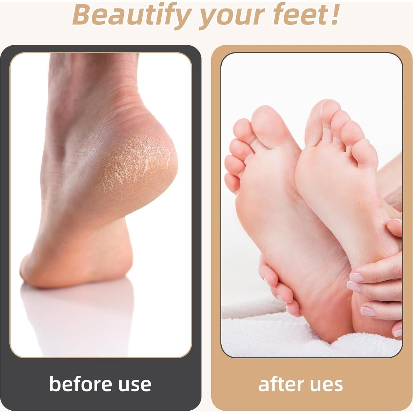 Removedor de Callos Eléctrico Incamity, Lima Portátil para Pies