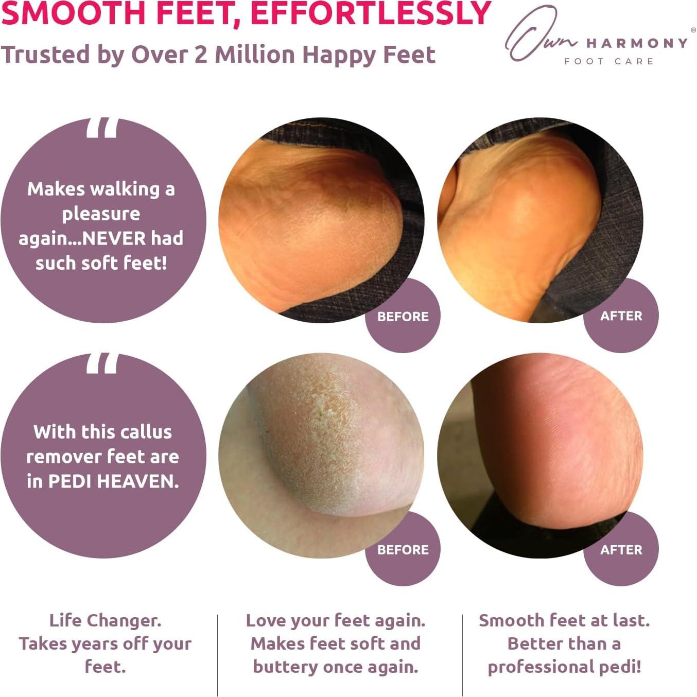 Removedor de Callos Eléctrico Own Harmony CR1700 Rosa Satinado