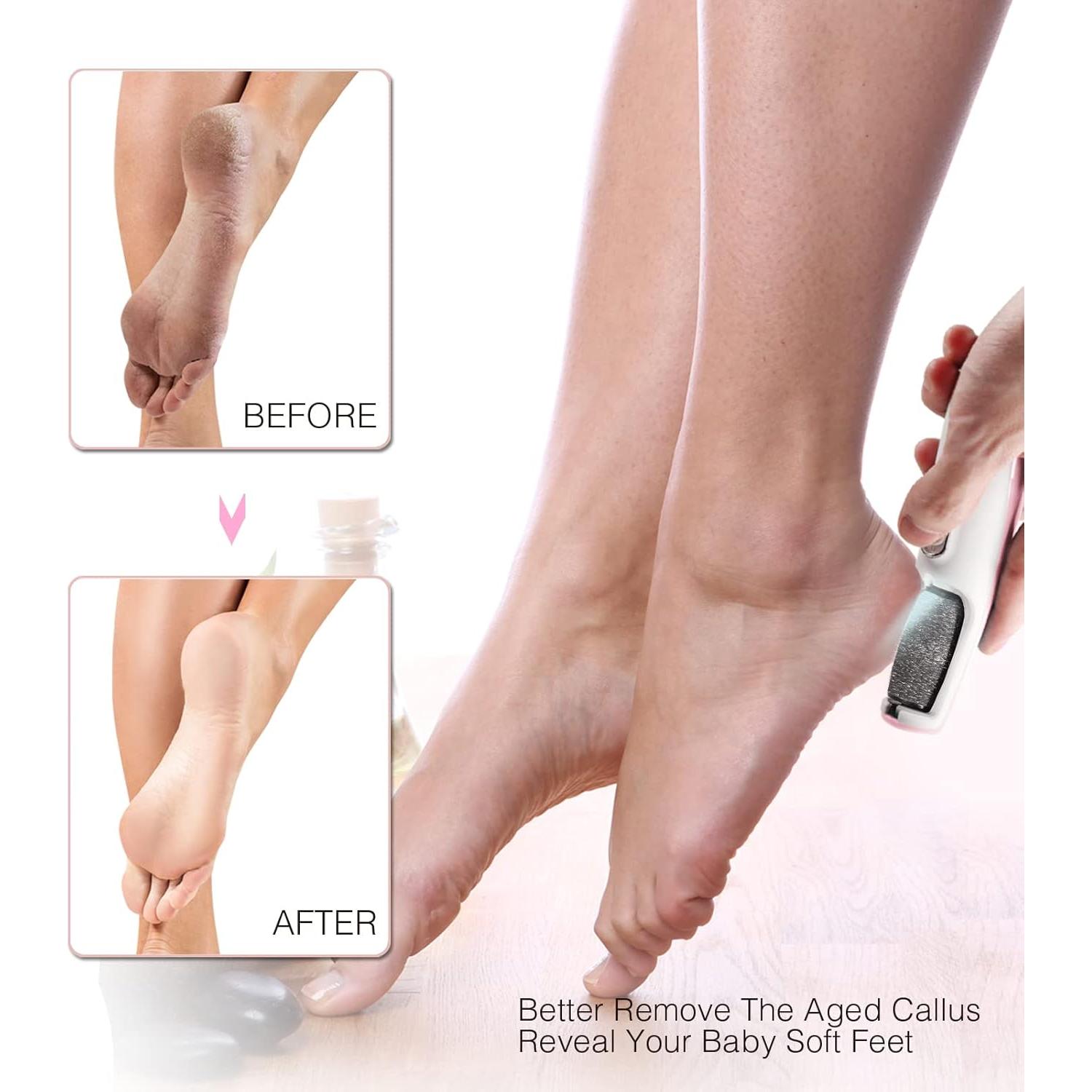 Removedor de Callos Eléctrico AM 8:00 Rosa, Recargable con Luz LED