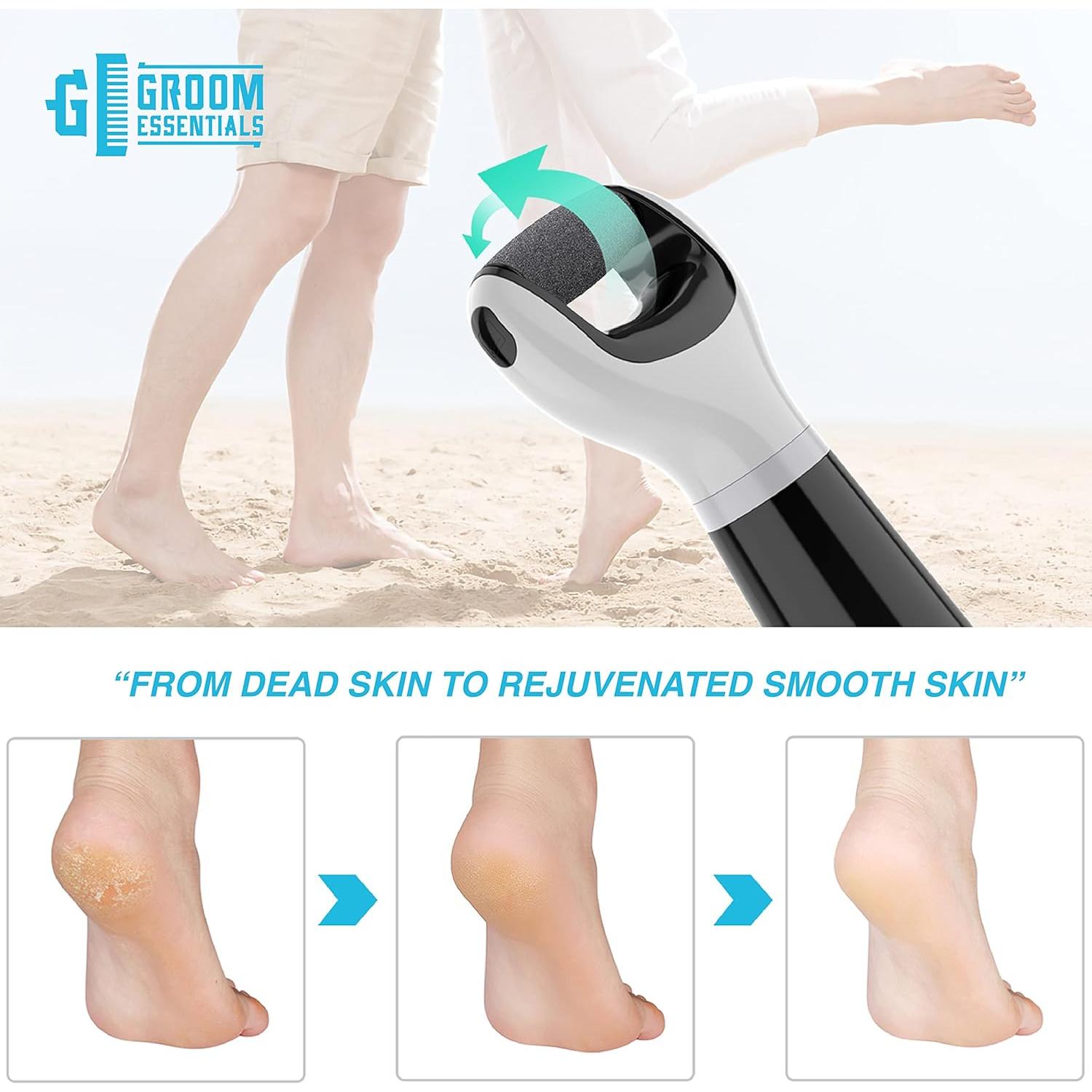 Removedor de Callos Eléctrico ChargeWorx GE401 Inalámbrico