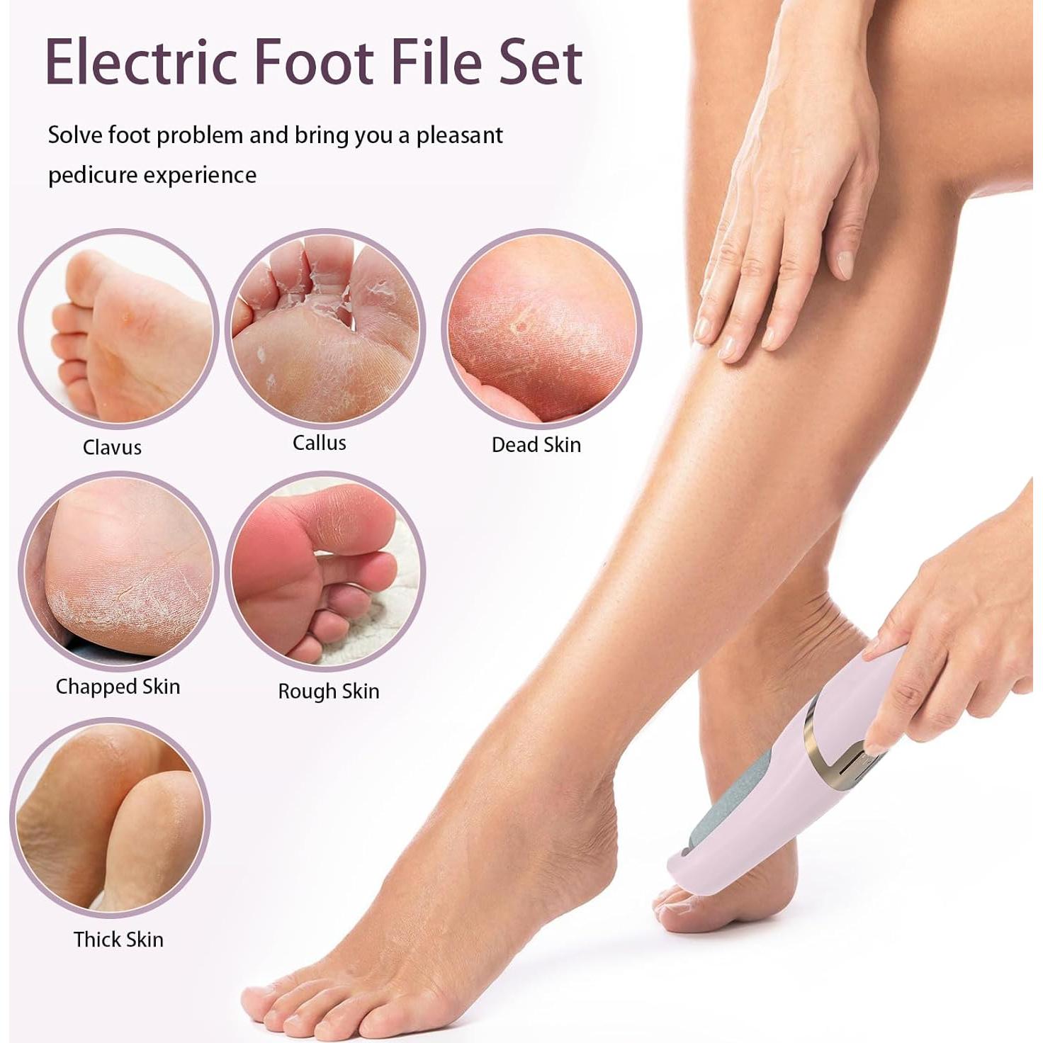 Removedor de Callos Eléctrico Conhaze Rosa, 2 Rodillos, 2 Velocidades