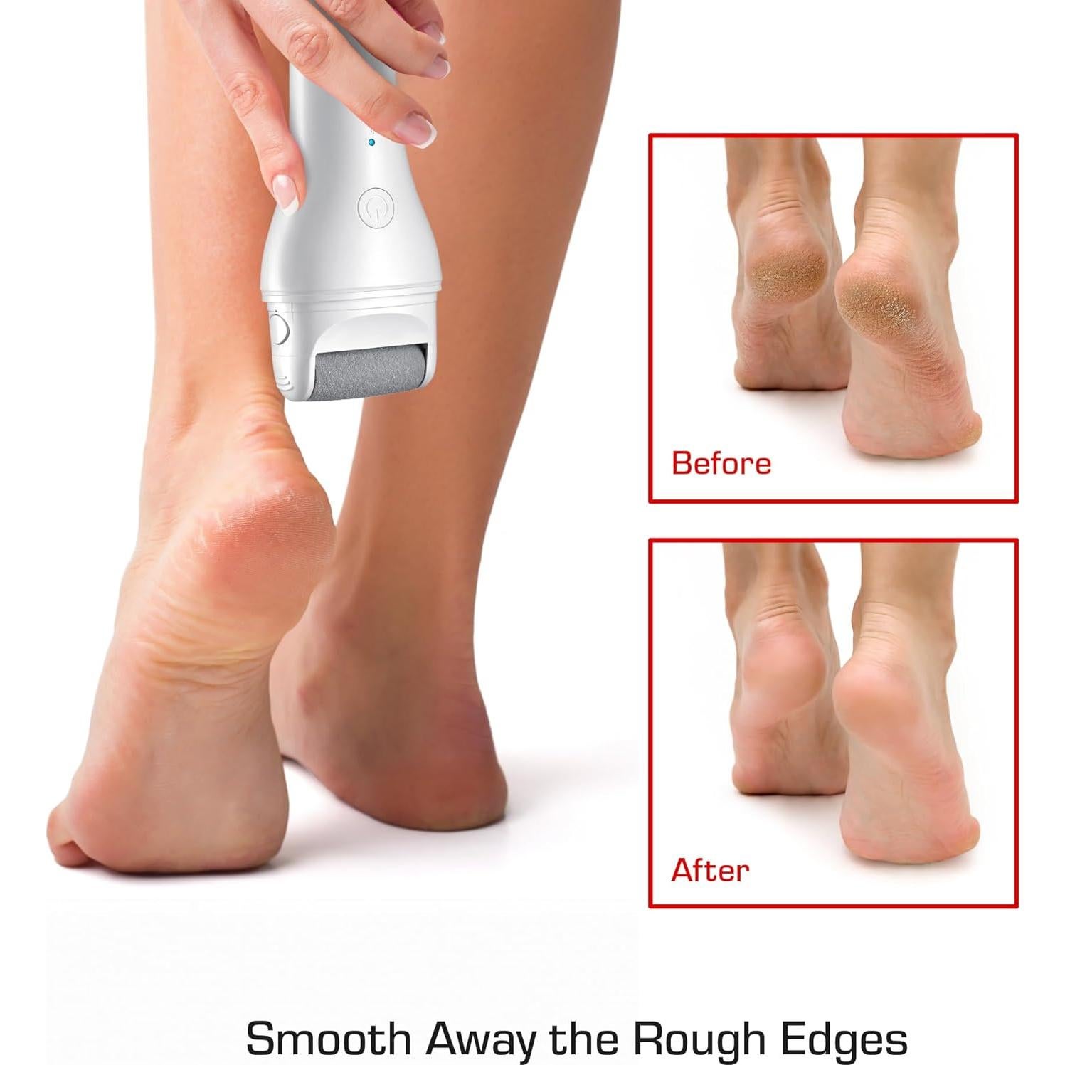 Removedor de Callos Eléctrico Inalámbrico Red by Kiss - 3 Rodillos