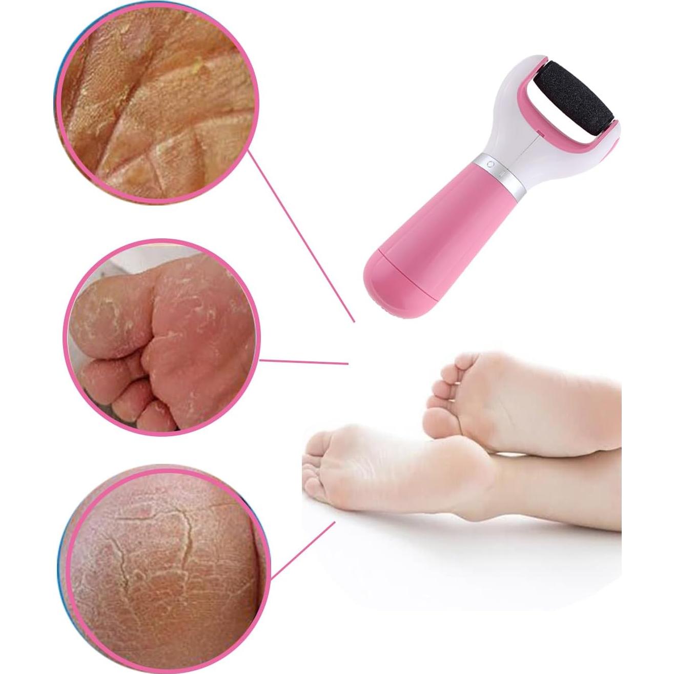 Removedor de Callos Eléctrico WenTigDY Rosa con Rodillo