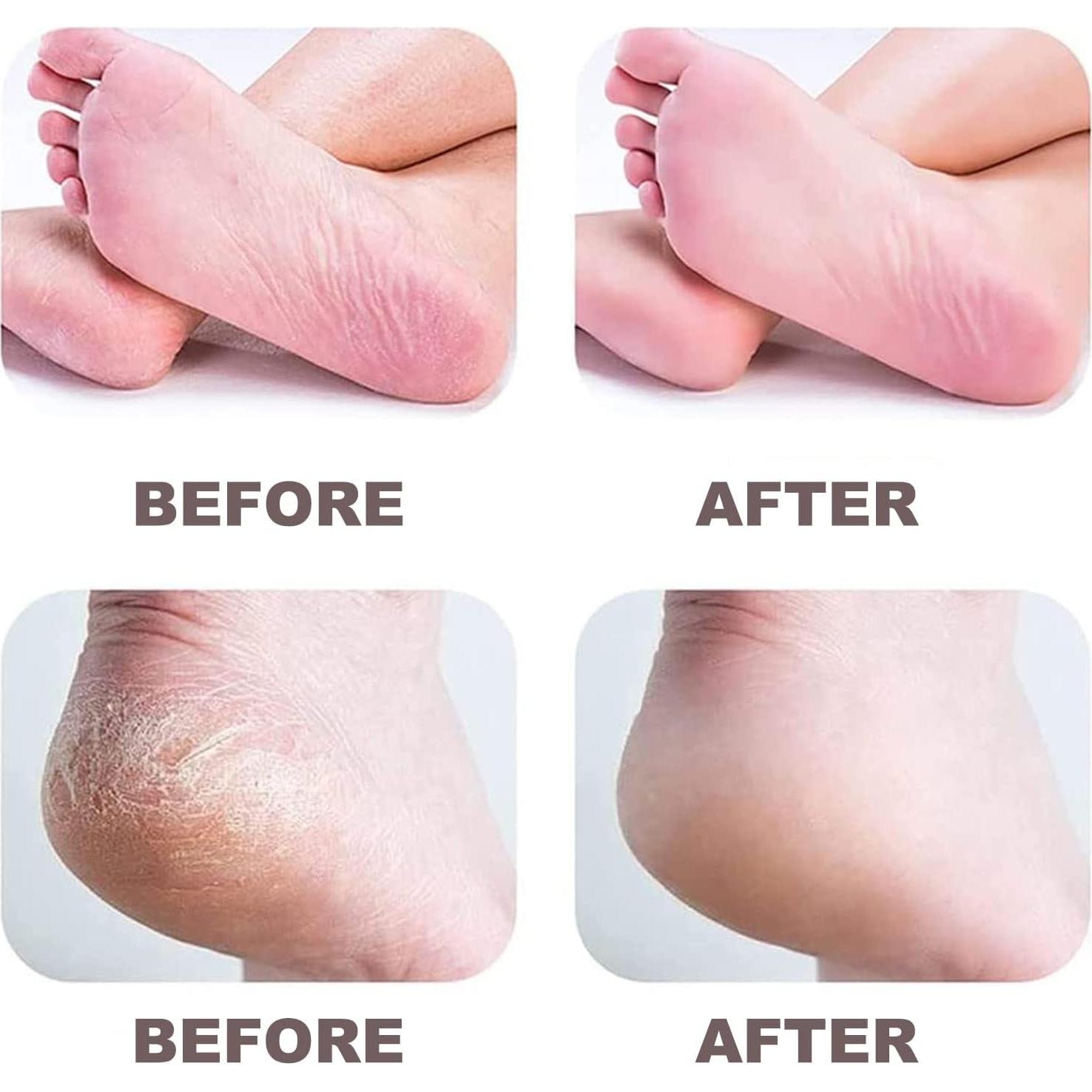 Lima Eléctrica para Pies Aricean - Removedor de Callos 2 Rodillos