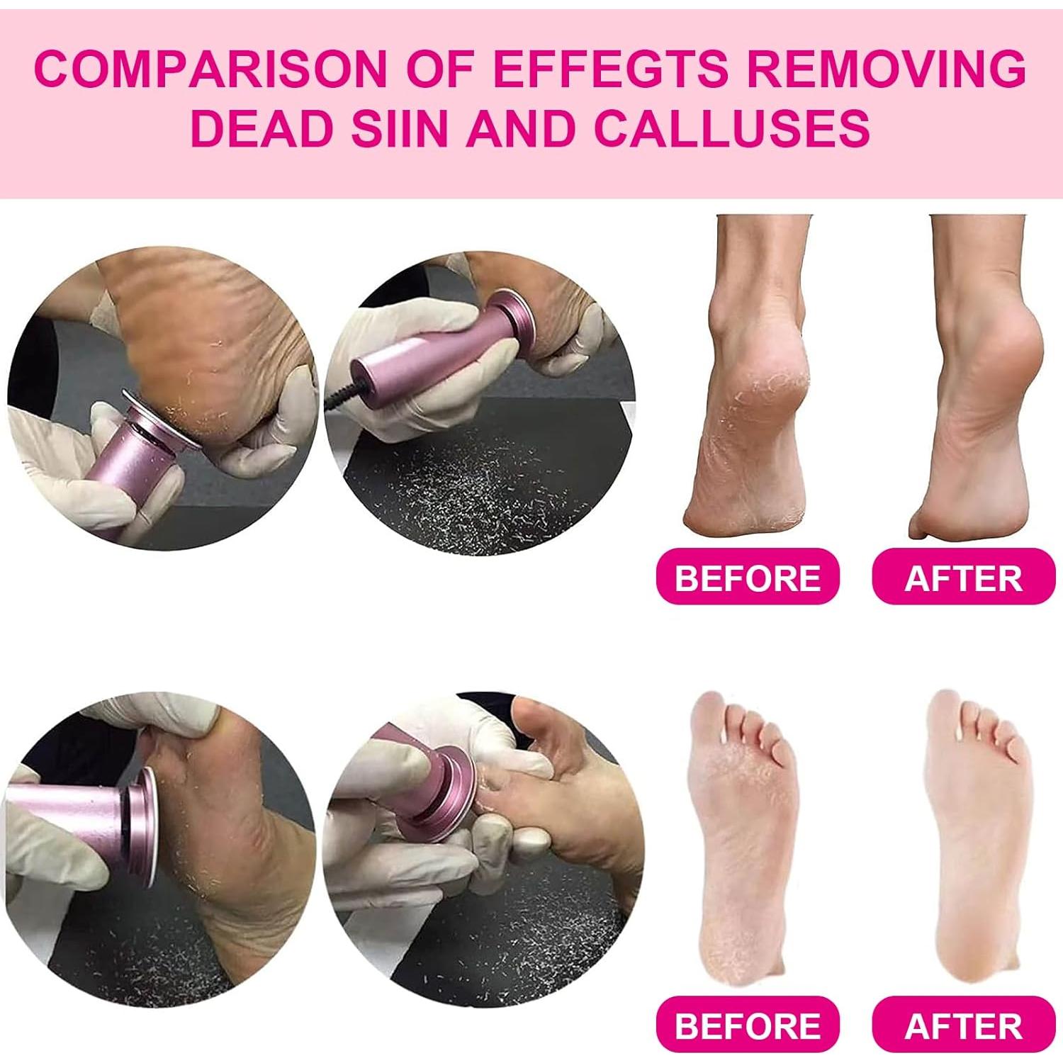 Removedor de Callos Eléctrico PENSDORE con 60 Papeles de Lija