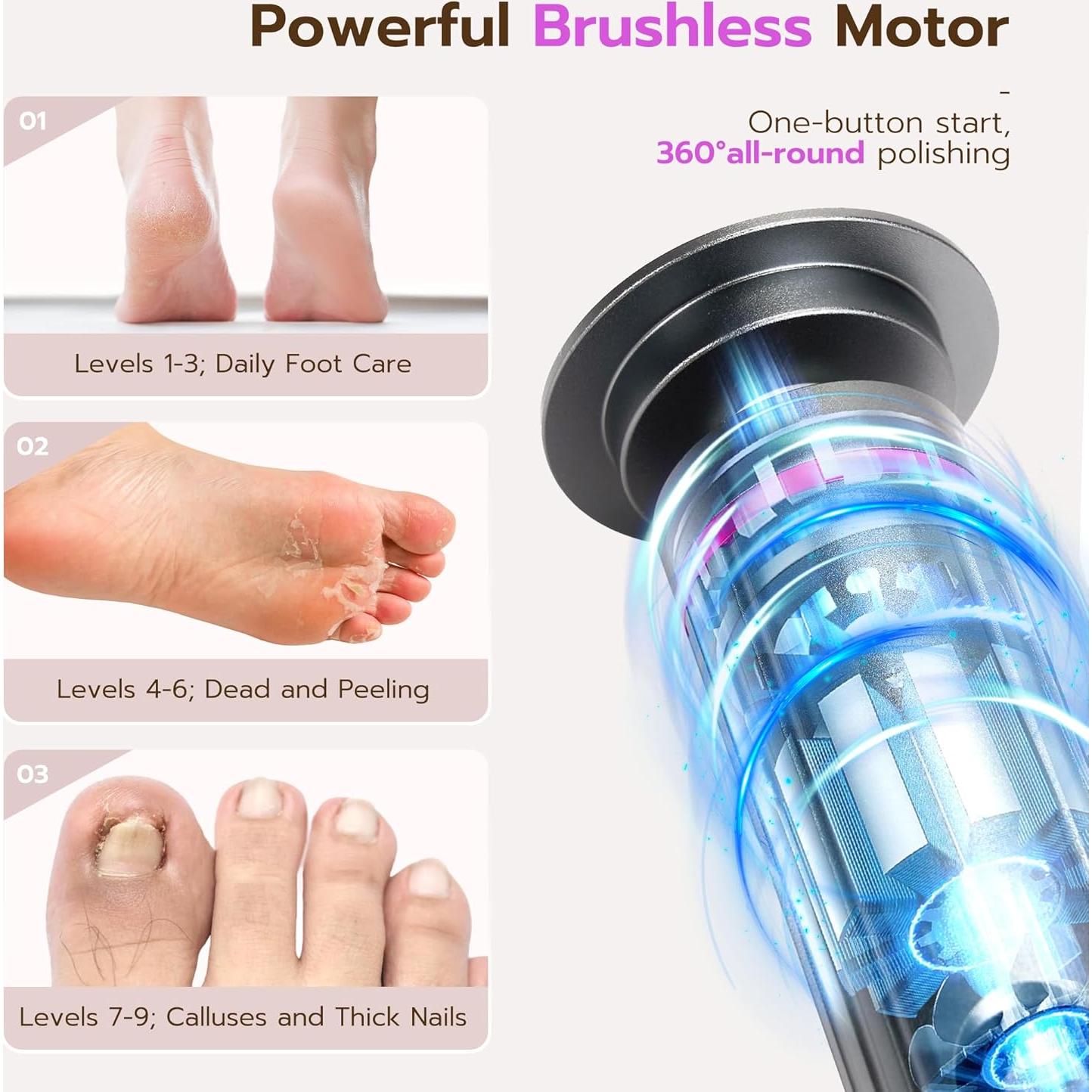 Removedor de Callos Eléctrico Cesekao Gris Oscuro 9 Velocidades