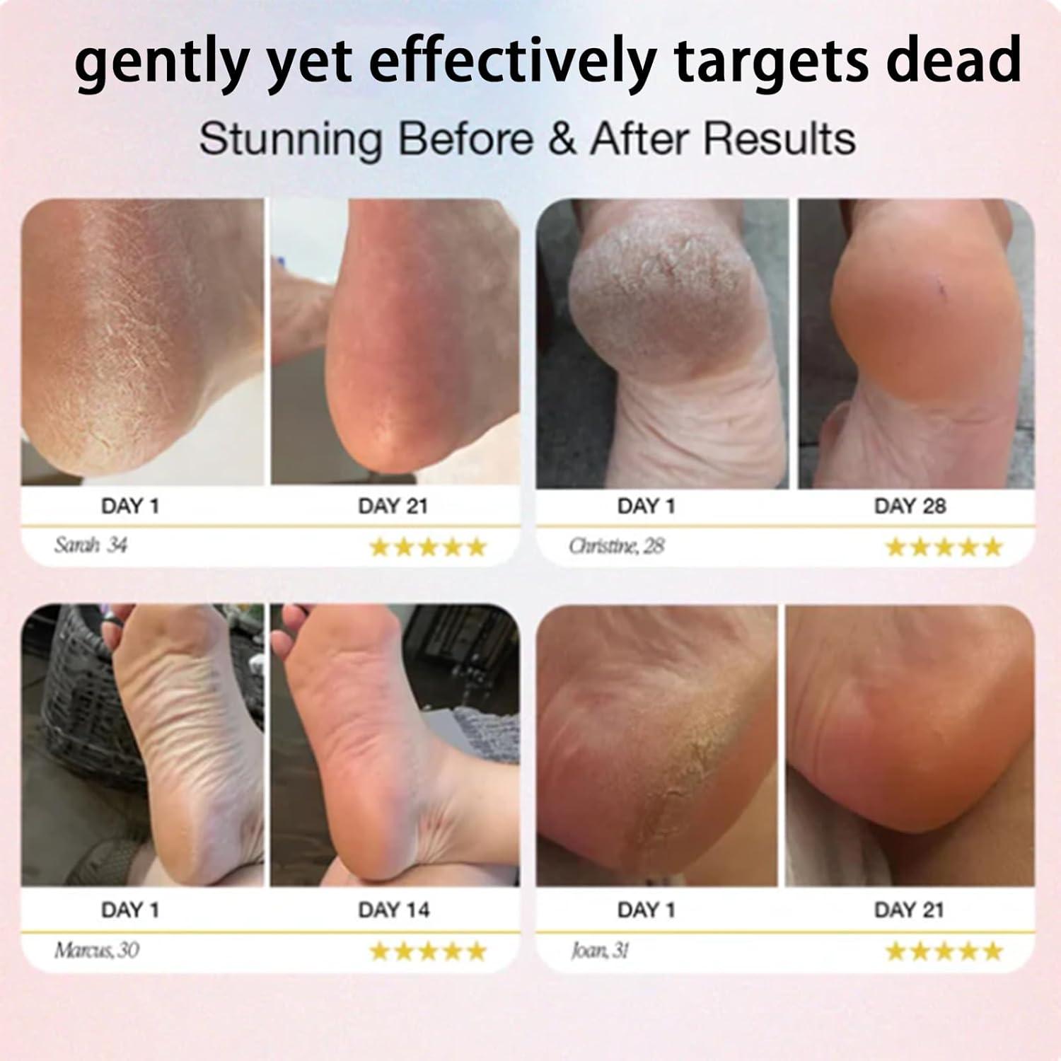 Removedor de Callos Eléctrico Permave Rosa y Blanco, 2 Velocidades