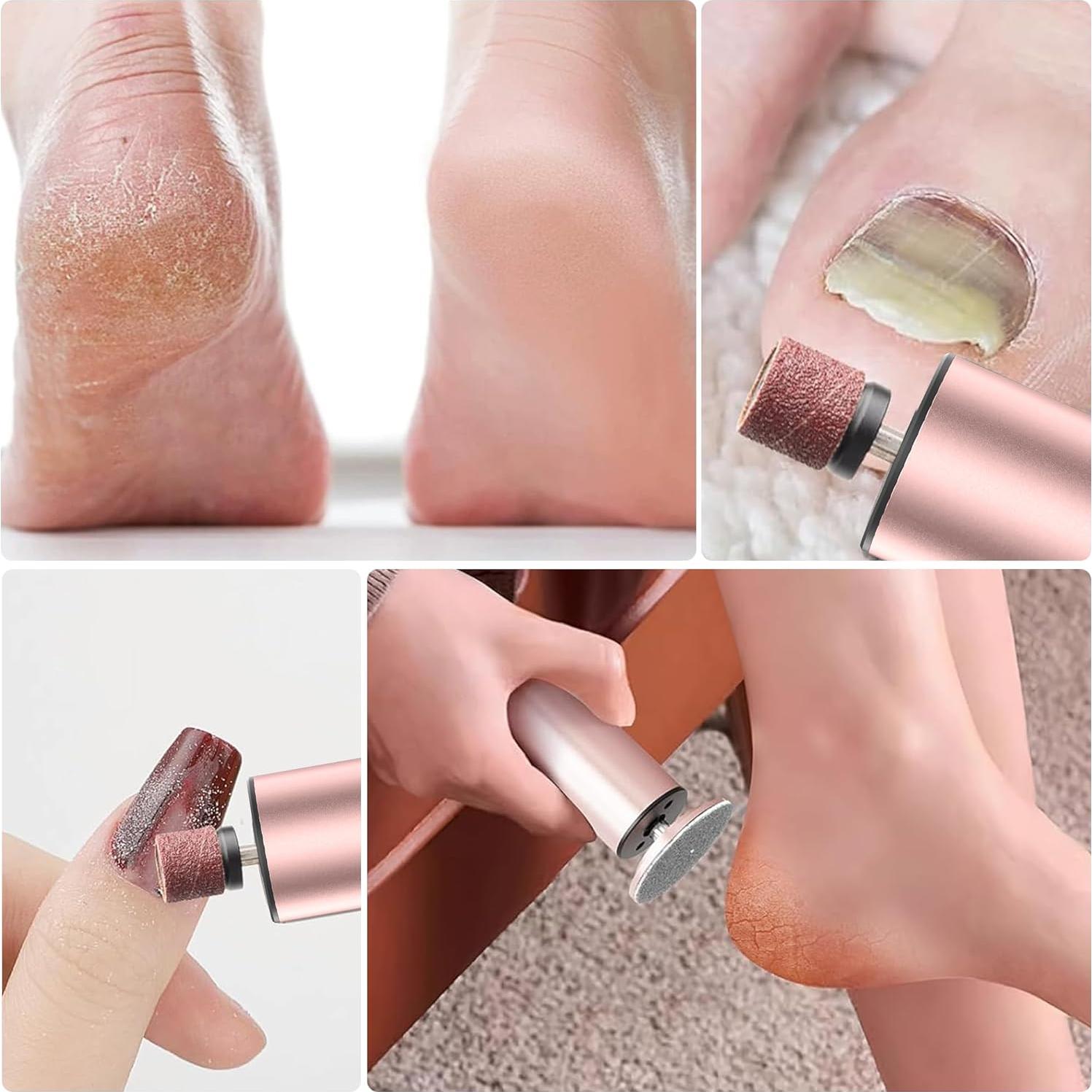 Removedor de Callos Eléctrico Bokynu MJQ-01 Rosa Recargable