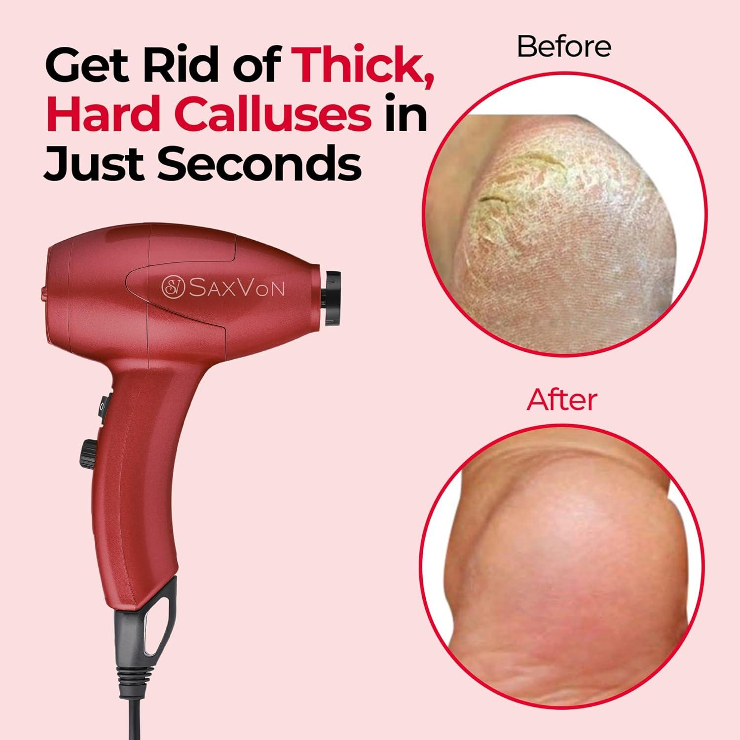 Máquina Eléctrica para Callos SaxVon FM101, 65W, 12 Accesorios